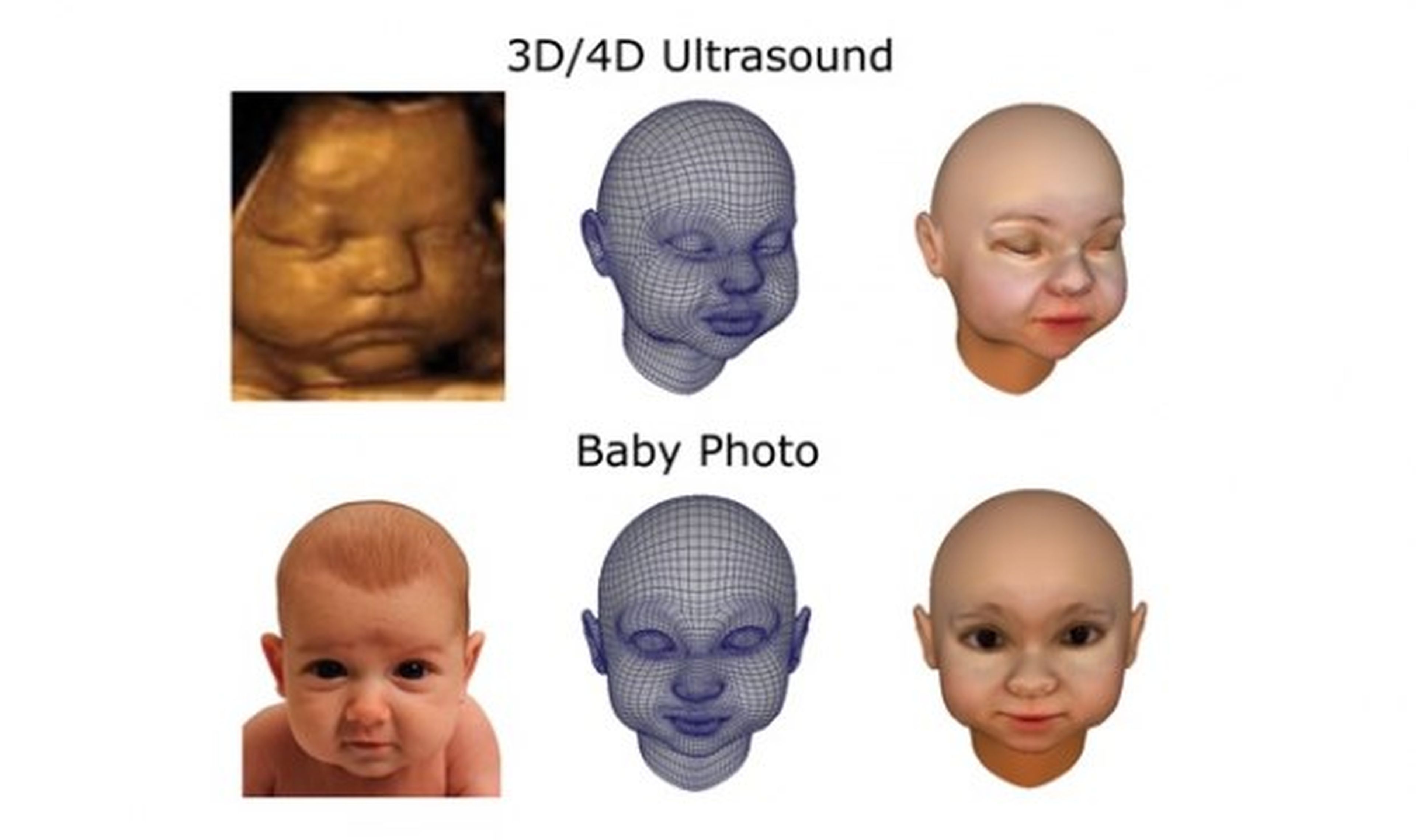 Empresa imprime fetos en 3D a partir de ecografías 4D