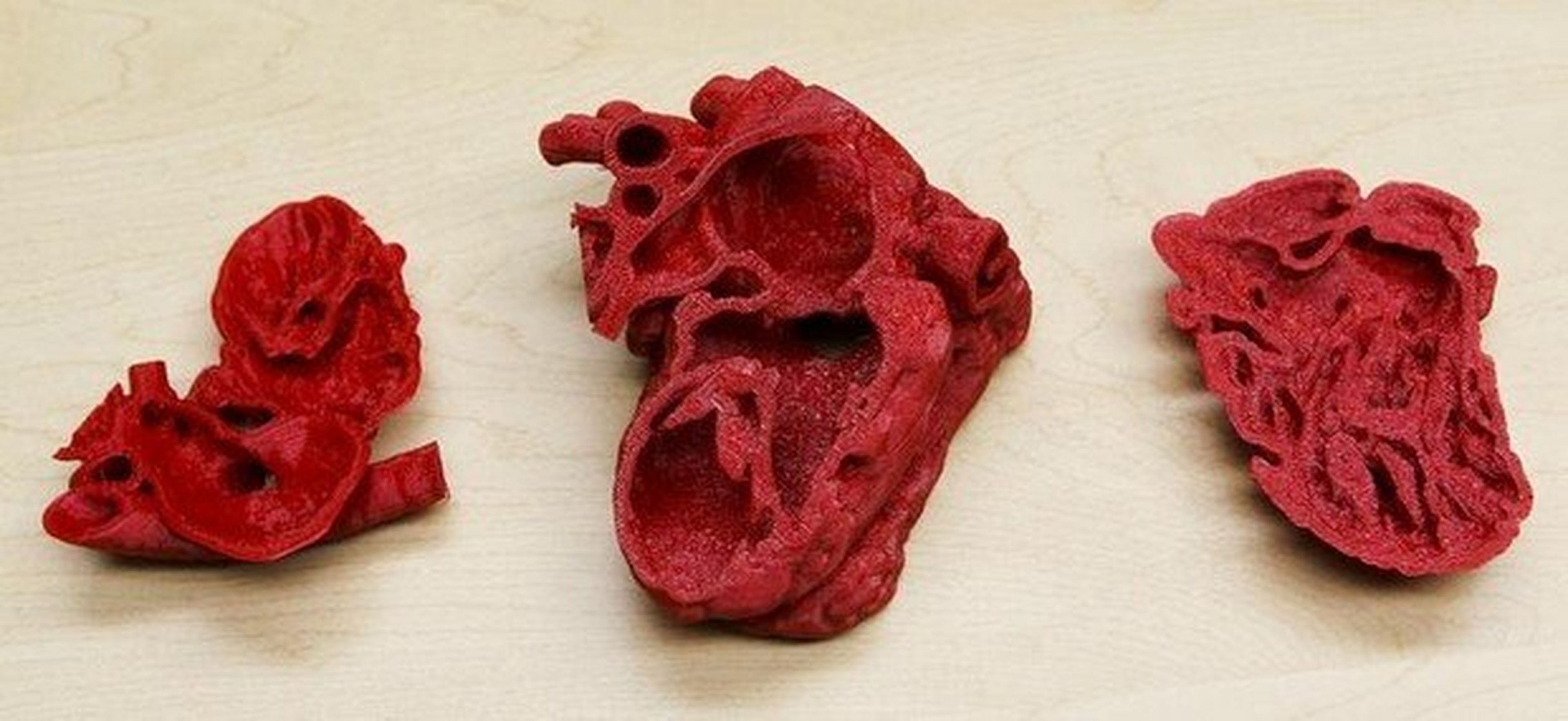 Un molde de su corazón impreso en 3D salva la vida a un niño