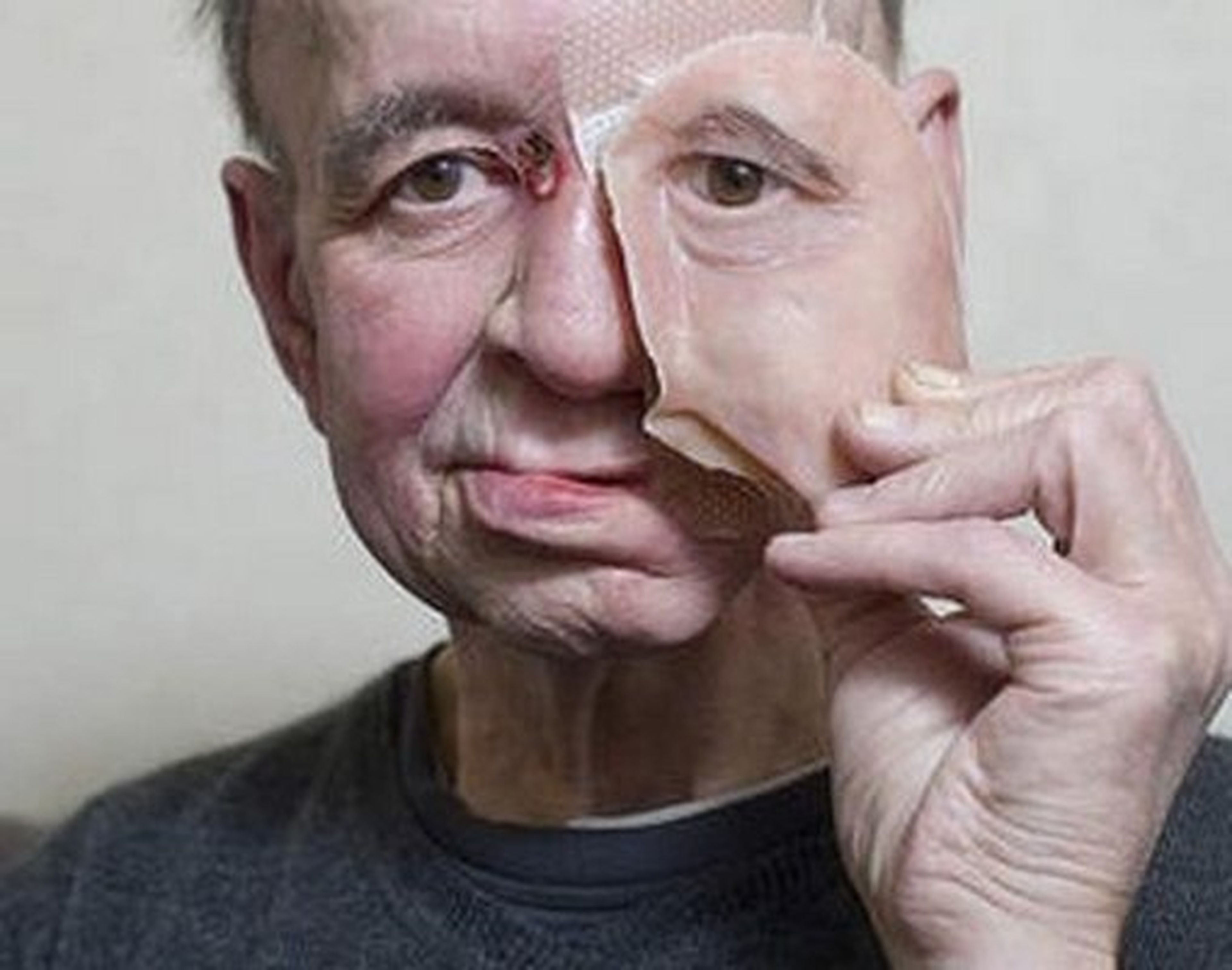 Prótesis facial con impresora 3D