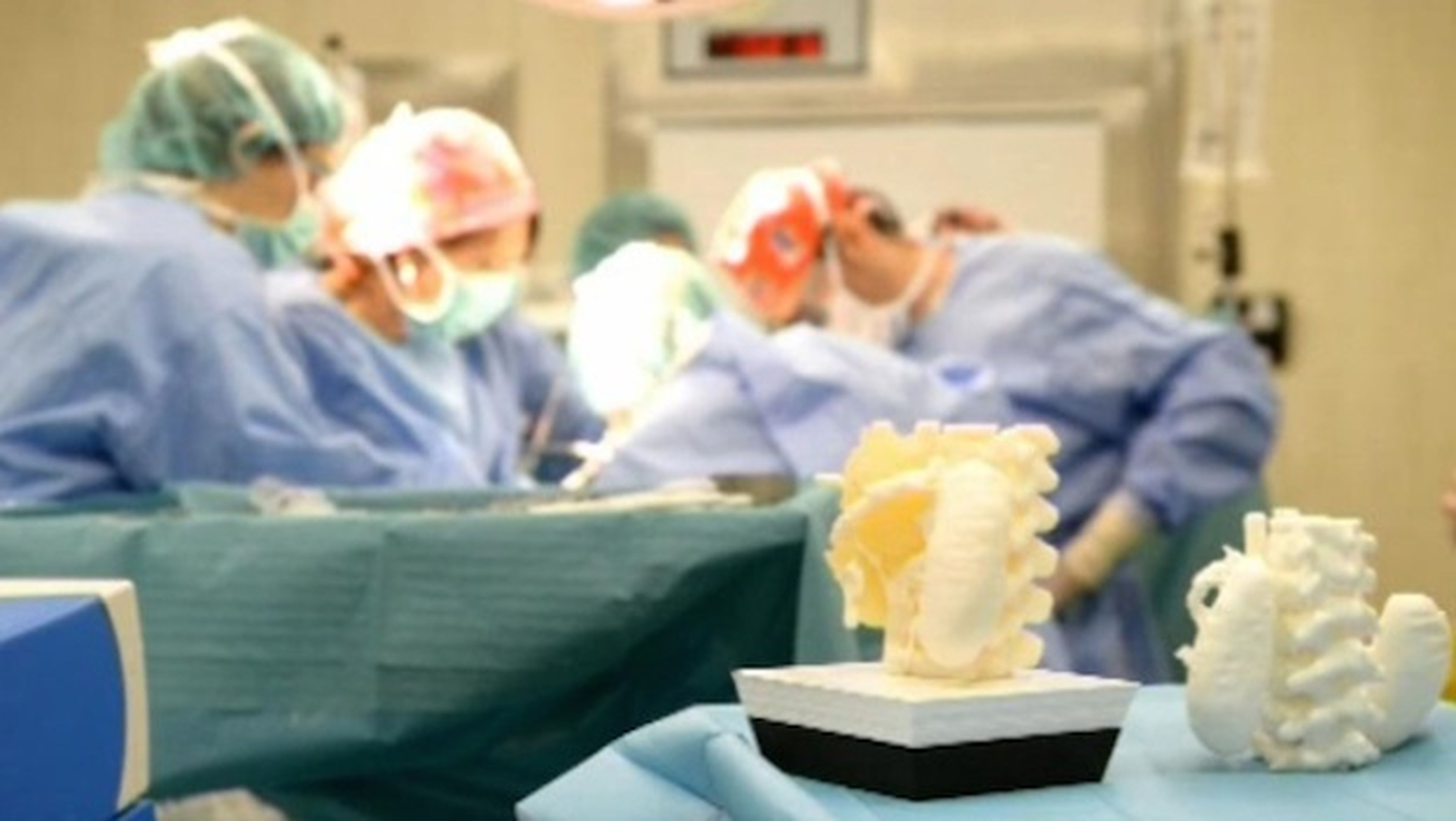 Tumor impreso en 3D ayuda a cirujanos con operación