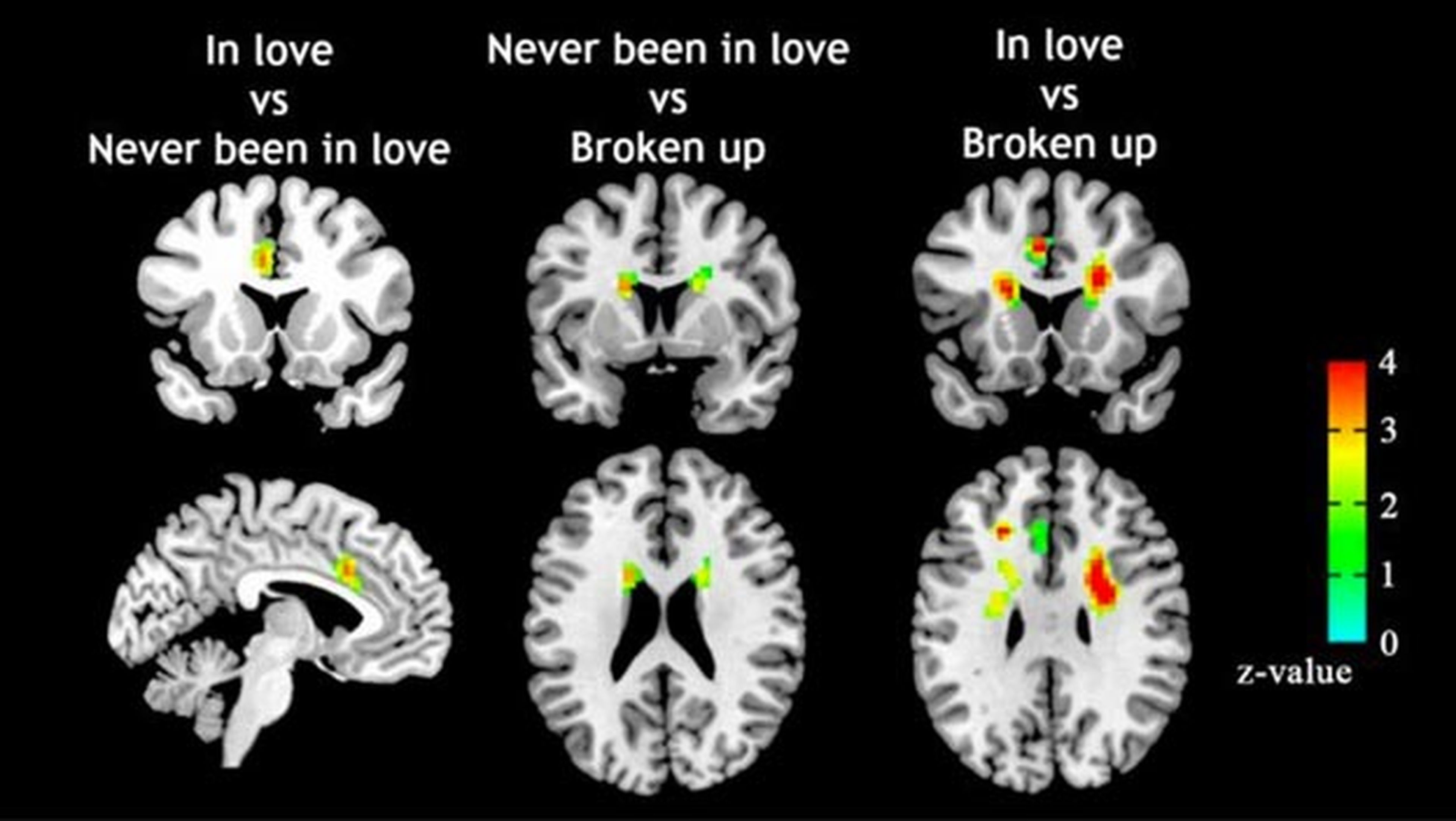 escáner cerebral comprobar si estñas enamorado