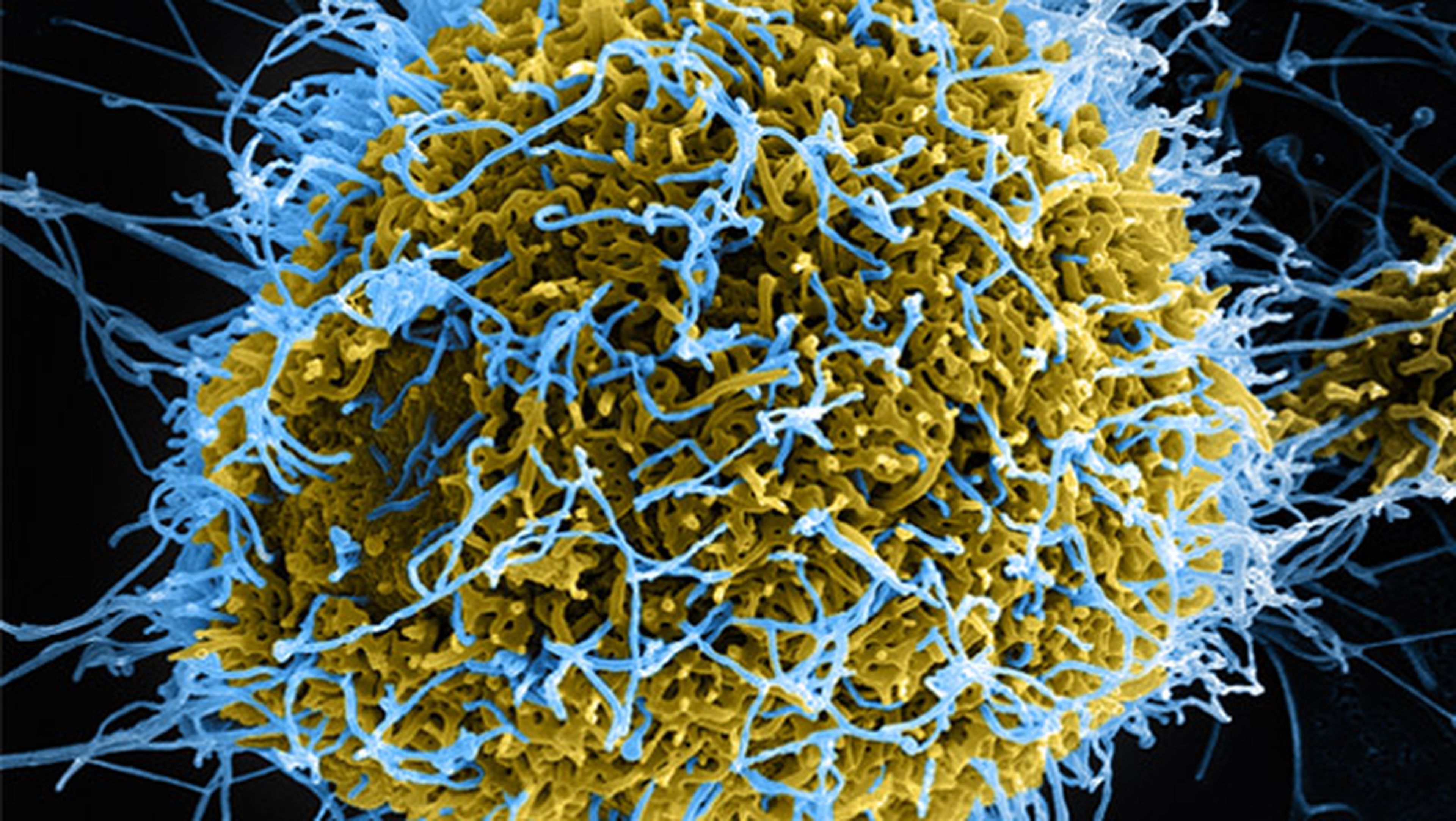 vacuna experimental ebola eficaz