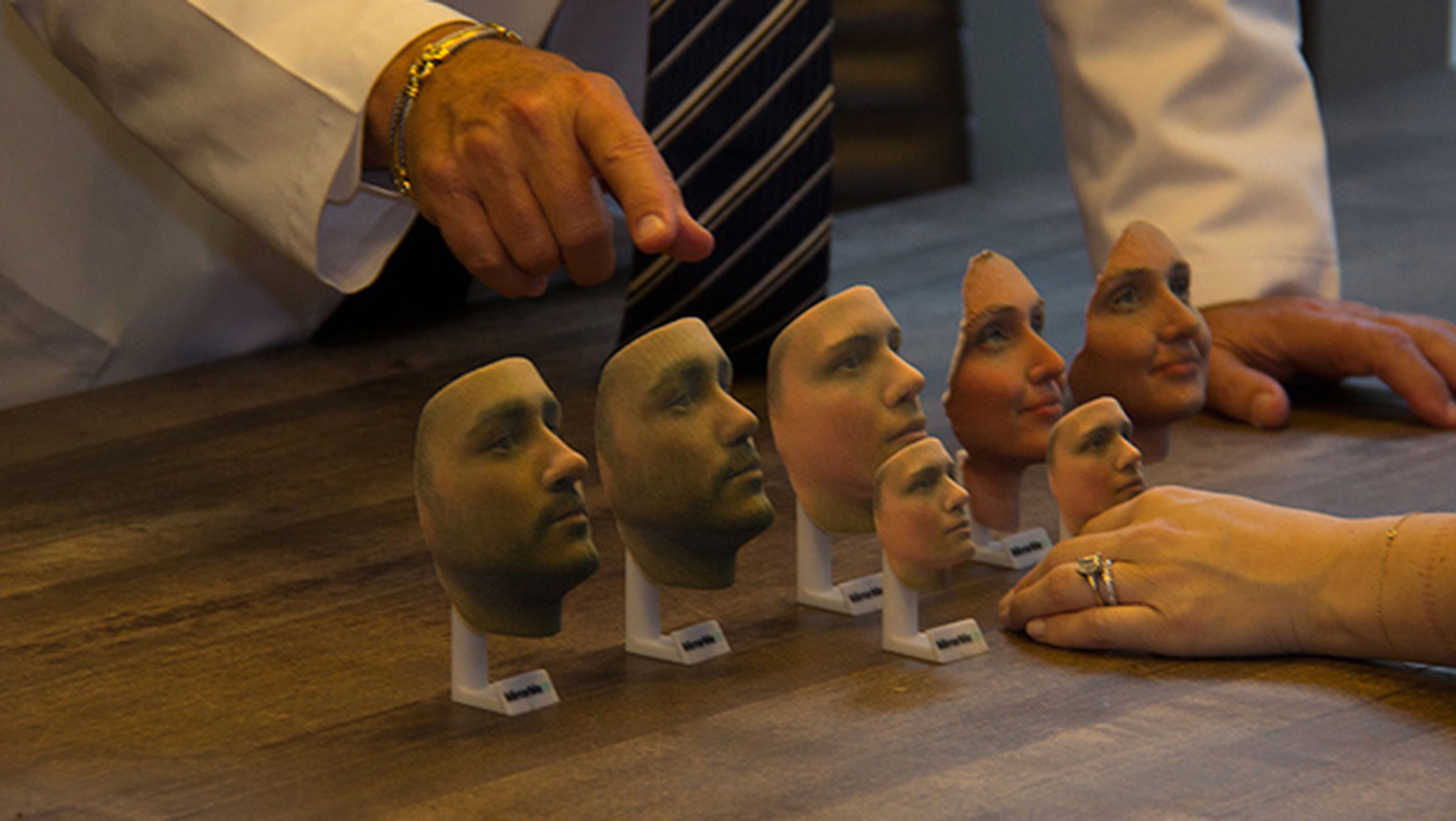 Modelo 3D muestra a los pacientes el resultado de la cirugía