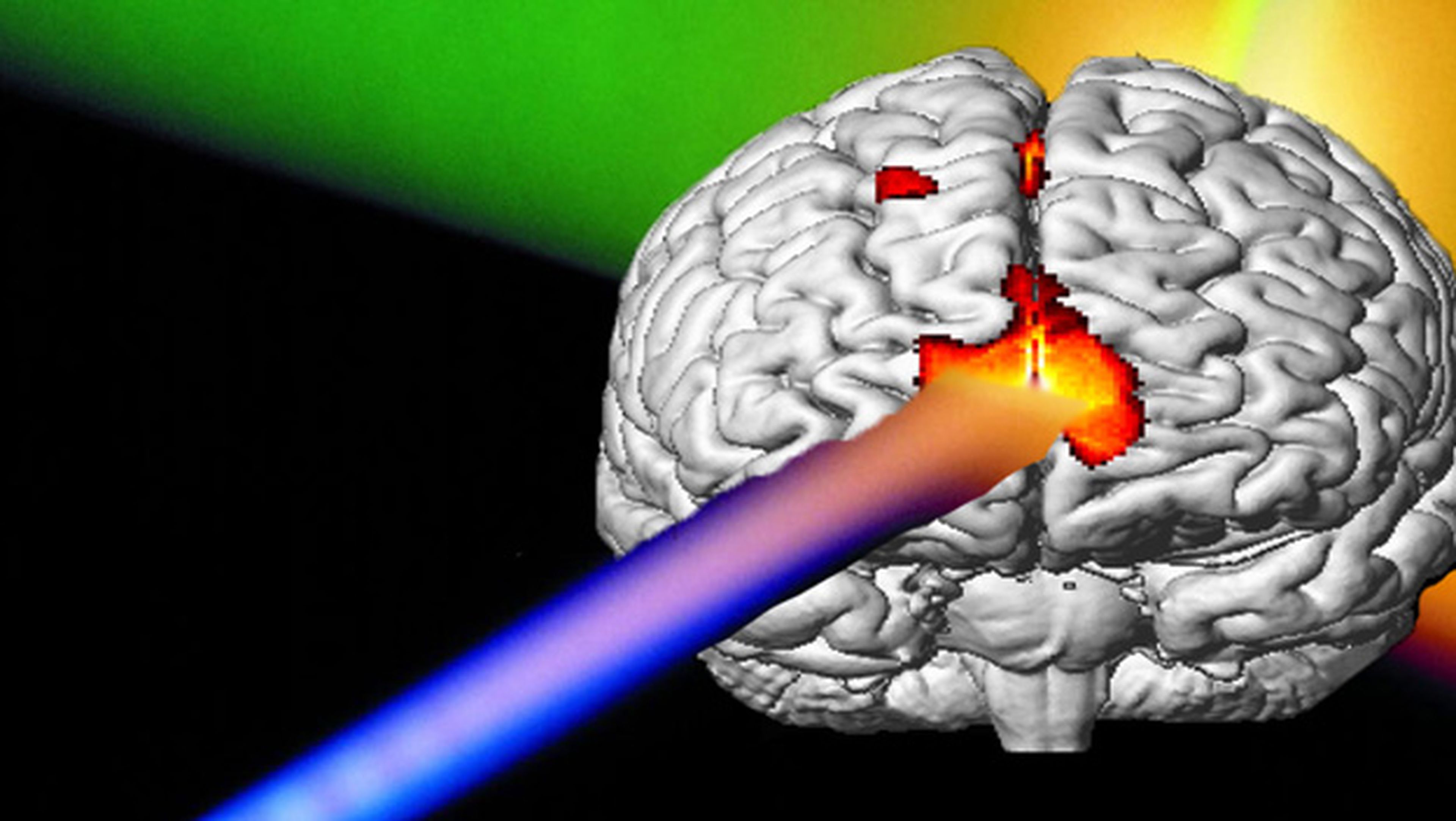 Laser cerebro