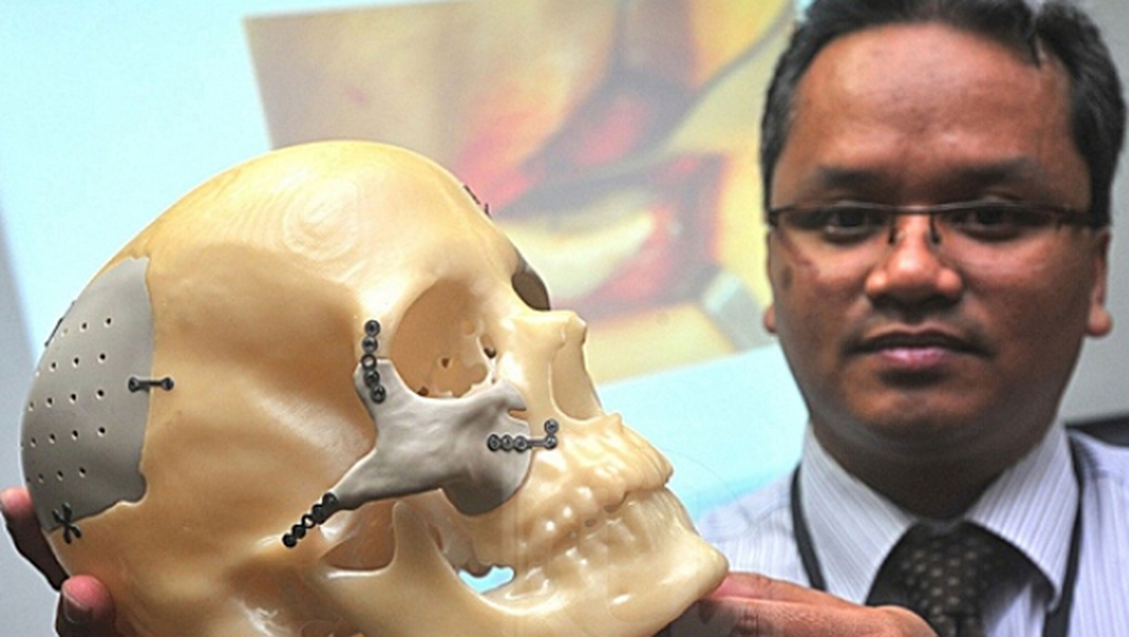 Un implante impreso en 3D reconstruye la cara de una mujer