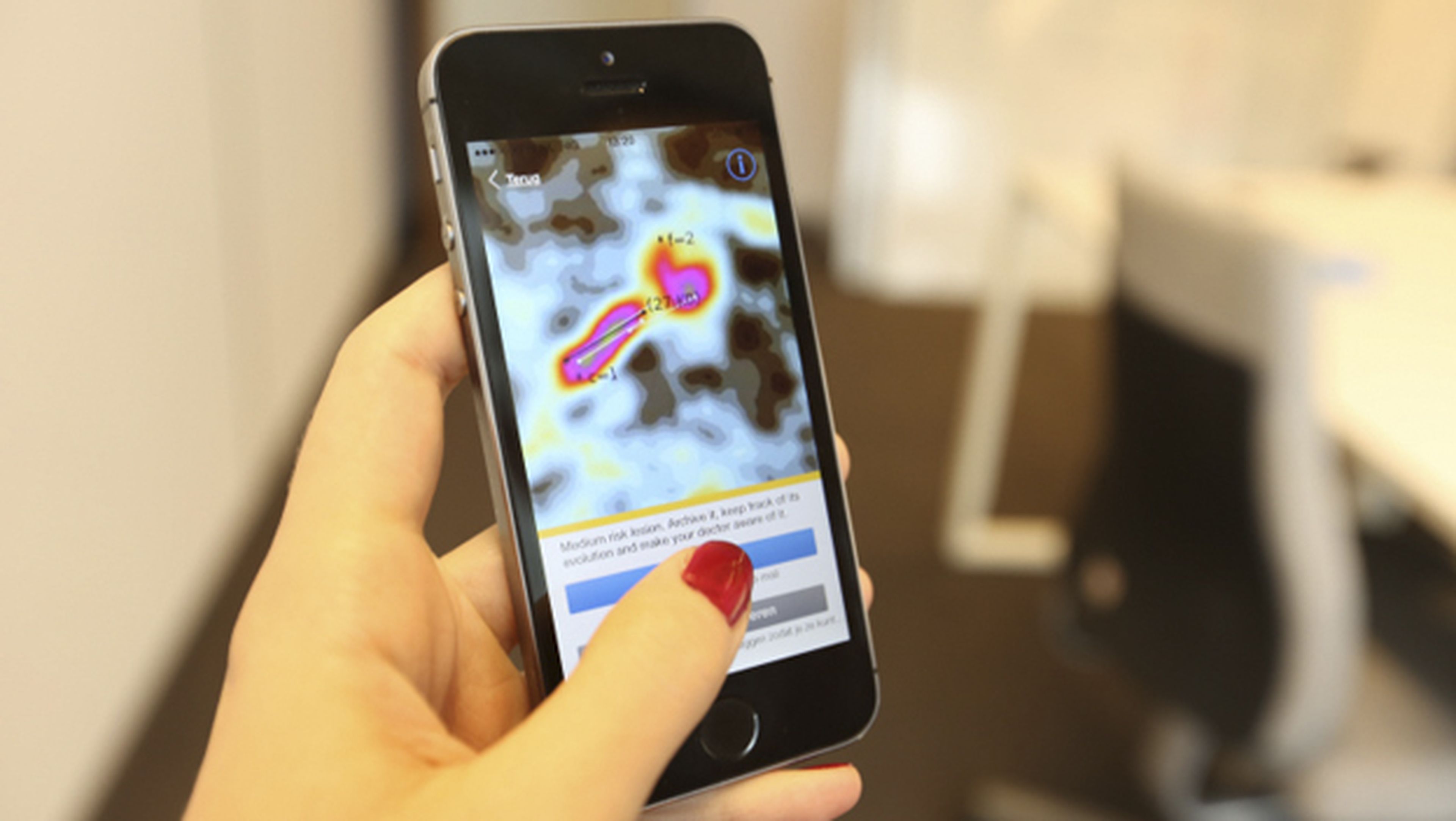 SkinVision, una app que detecta el cáncer de piel con el móvil