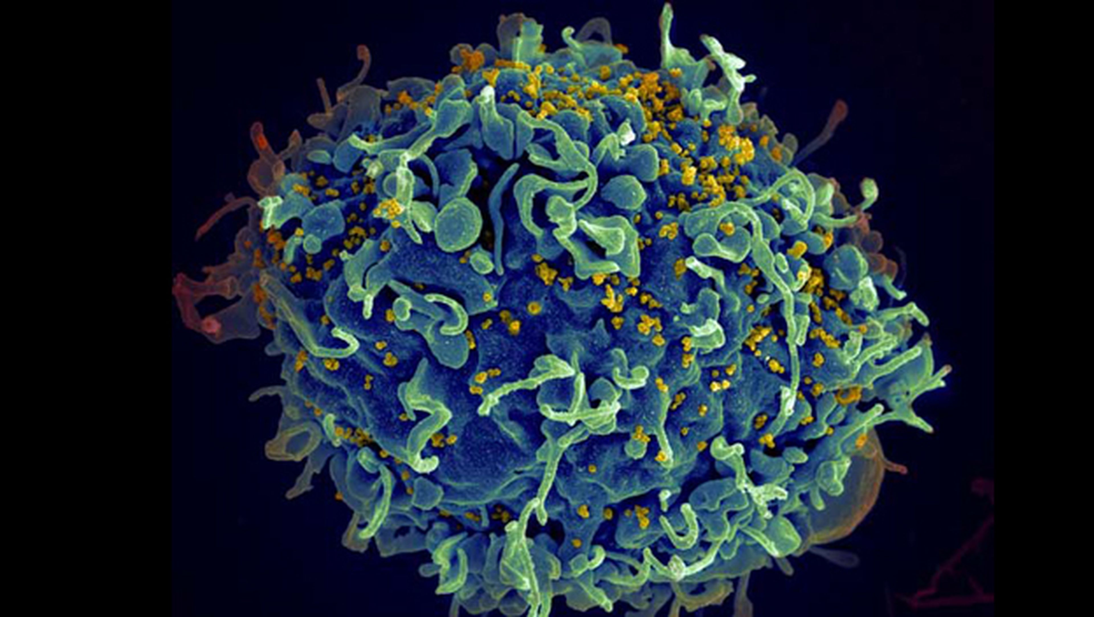 Descubren medicamento que puede erradicar el virus del sida