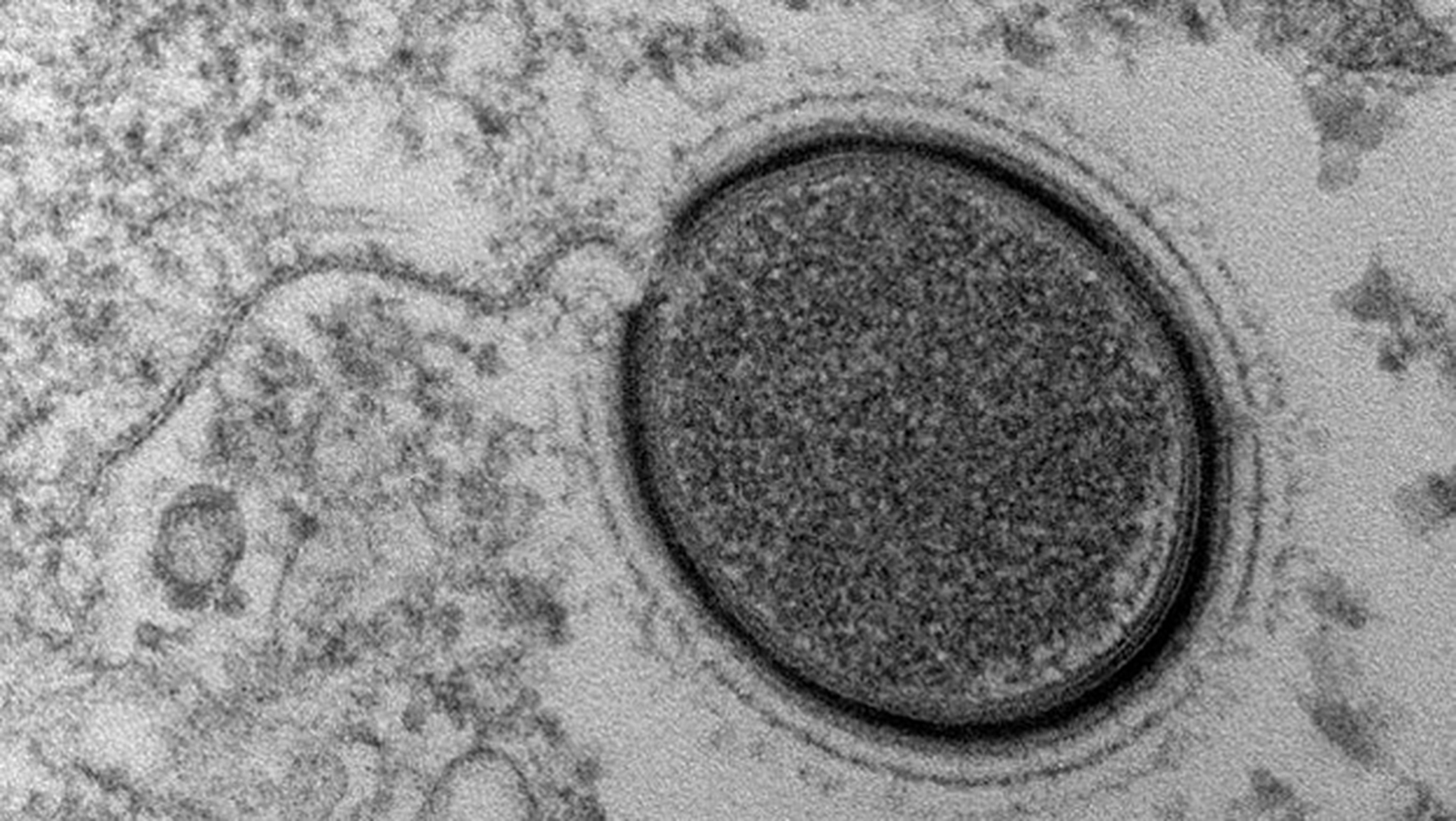 Científicos van a revivir un virus congelado durante 30.000 años