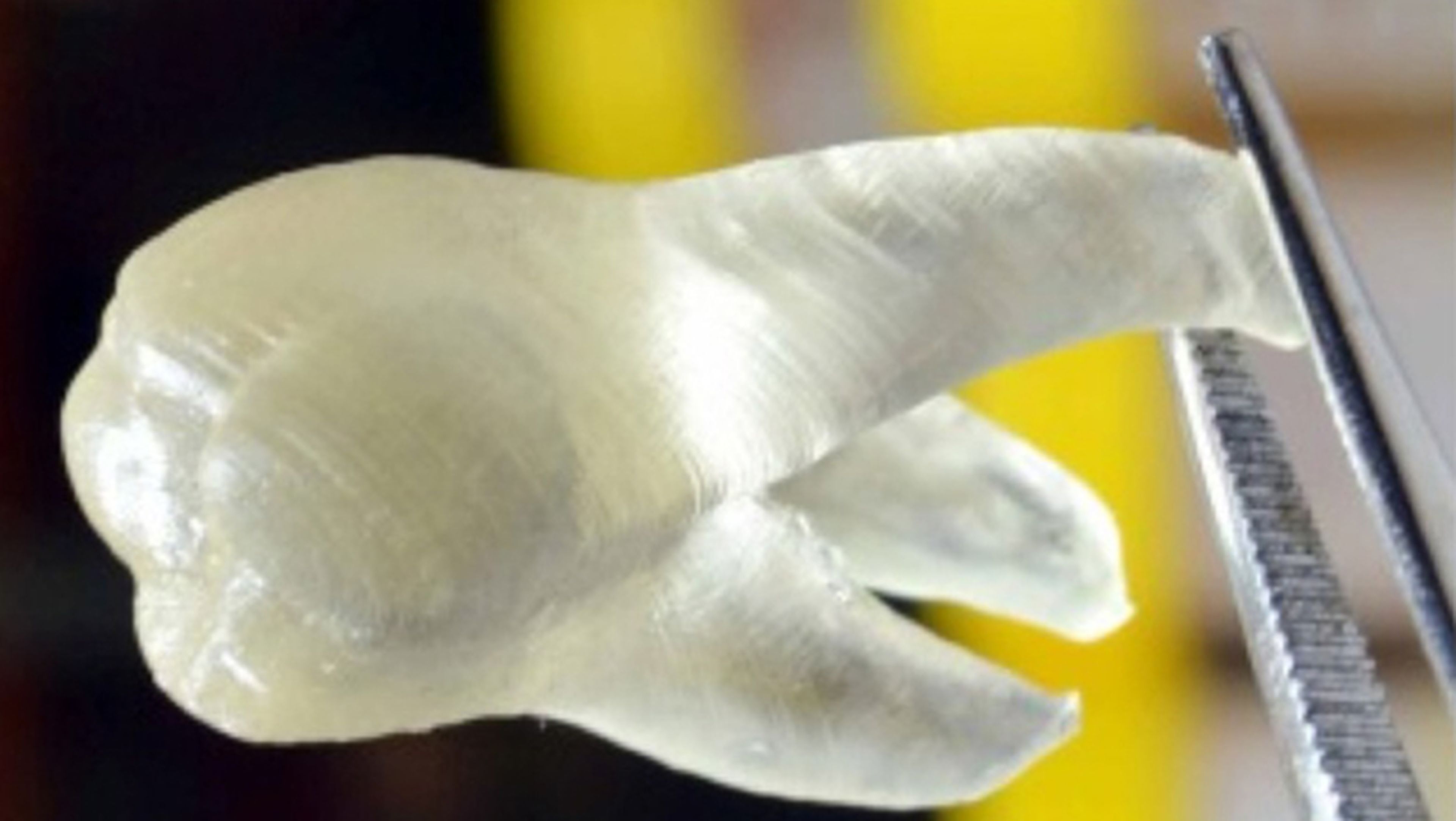 Implantes impresos en 3D matan bacterias y previenen caries