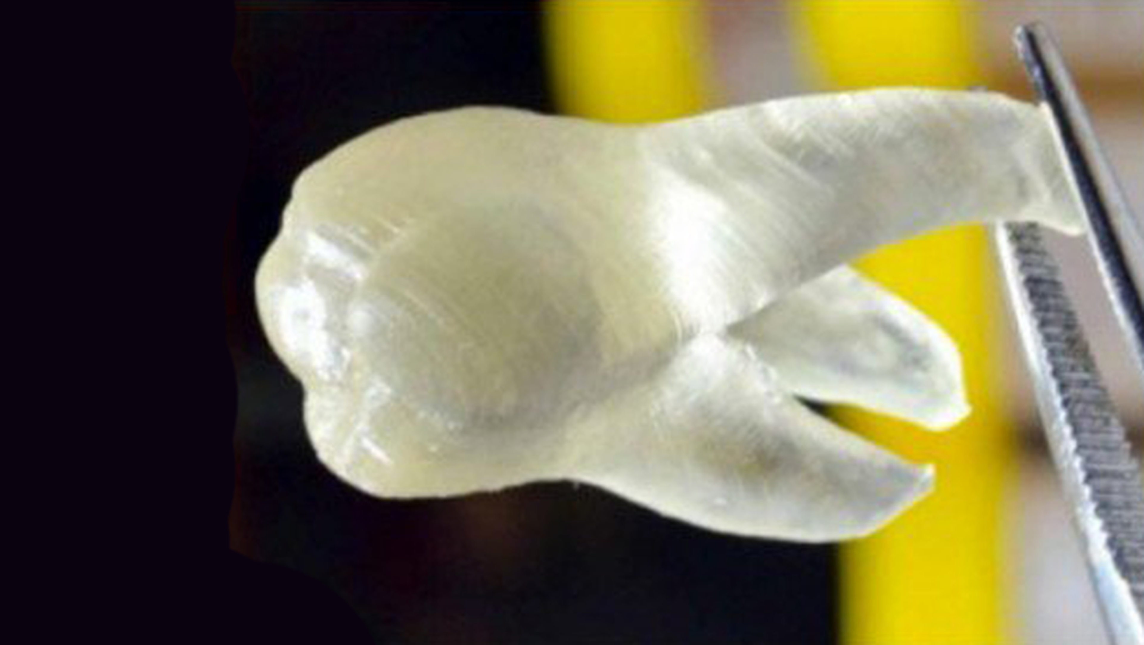 Impresoras 3D para imprimir dientes que matan las bacterias