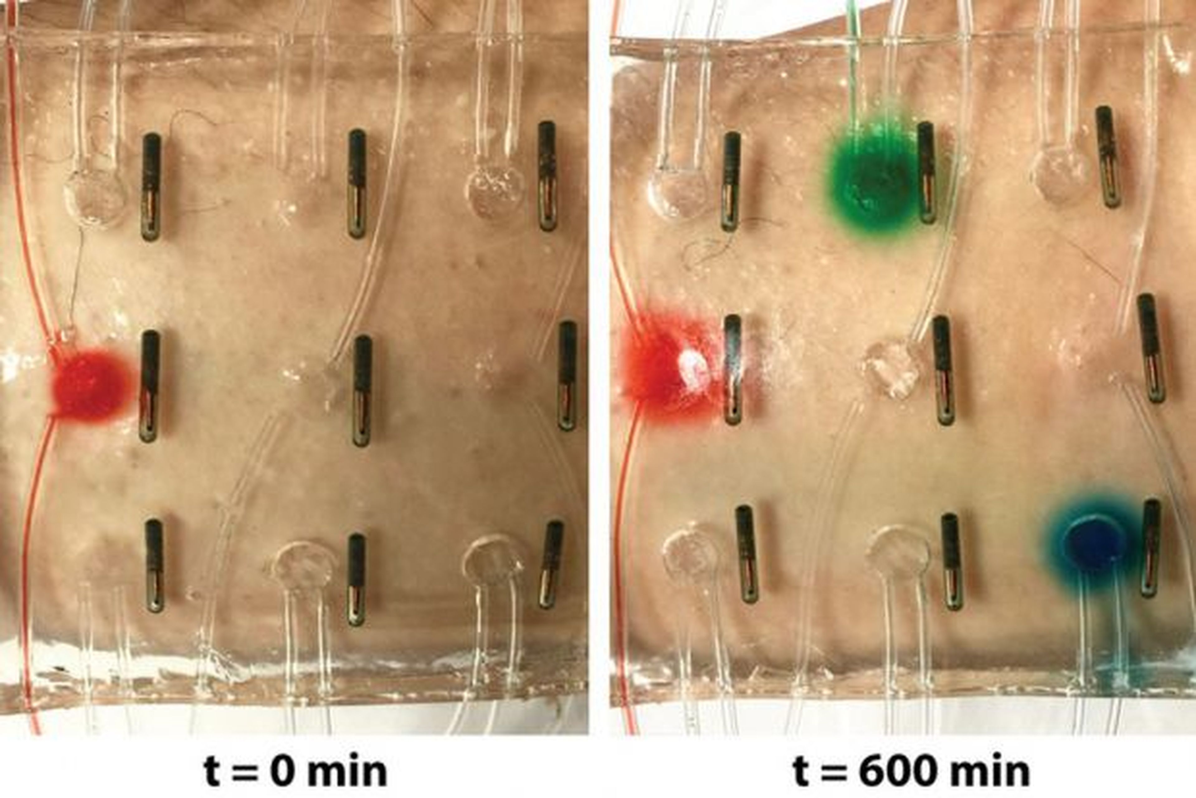 Un vendaje inteligente y electrónico para curar las heridas