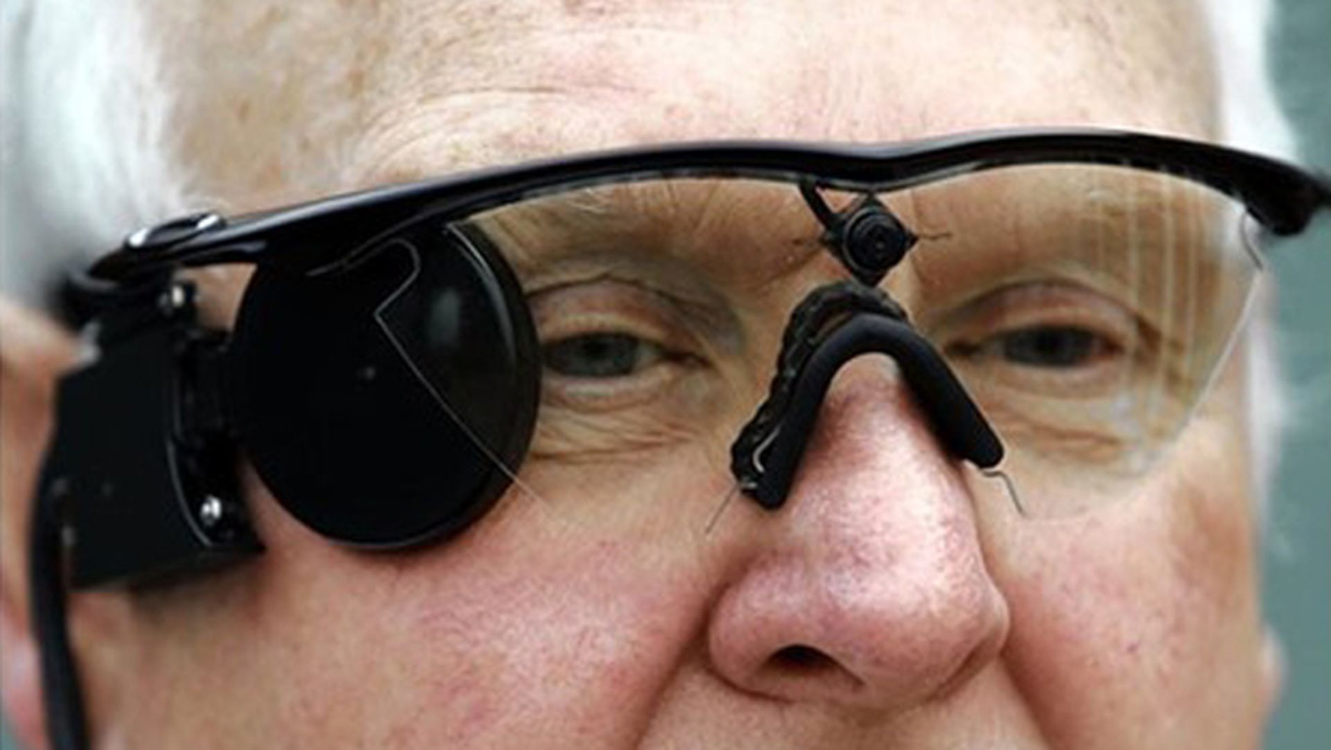 Implantan con éxito un ojo biónico a un barcelonés ciego