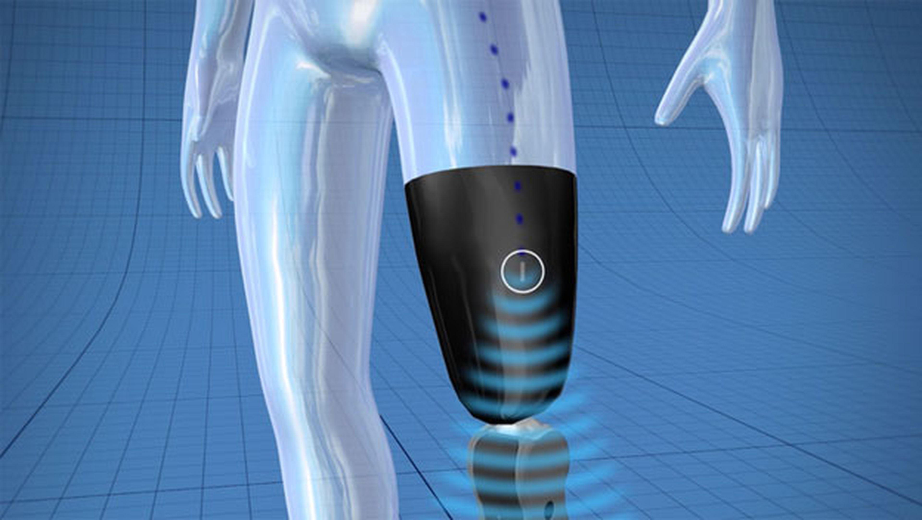 protesis bionica