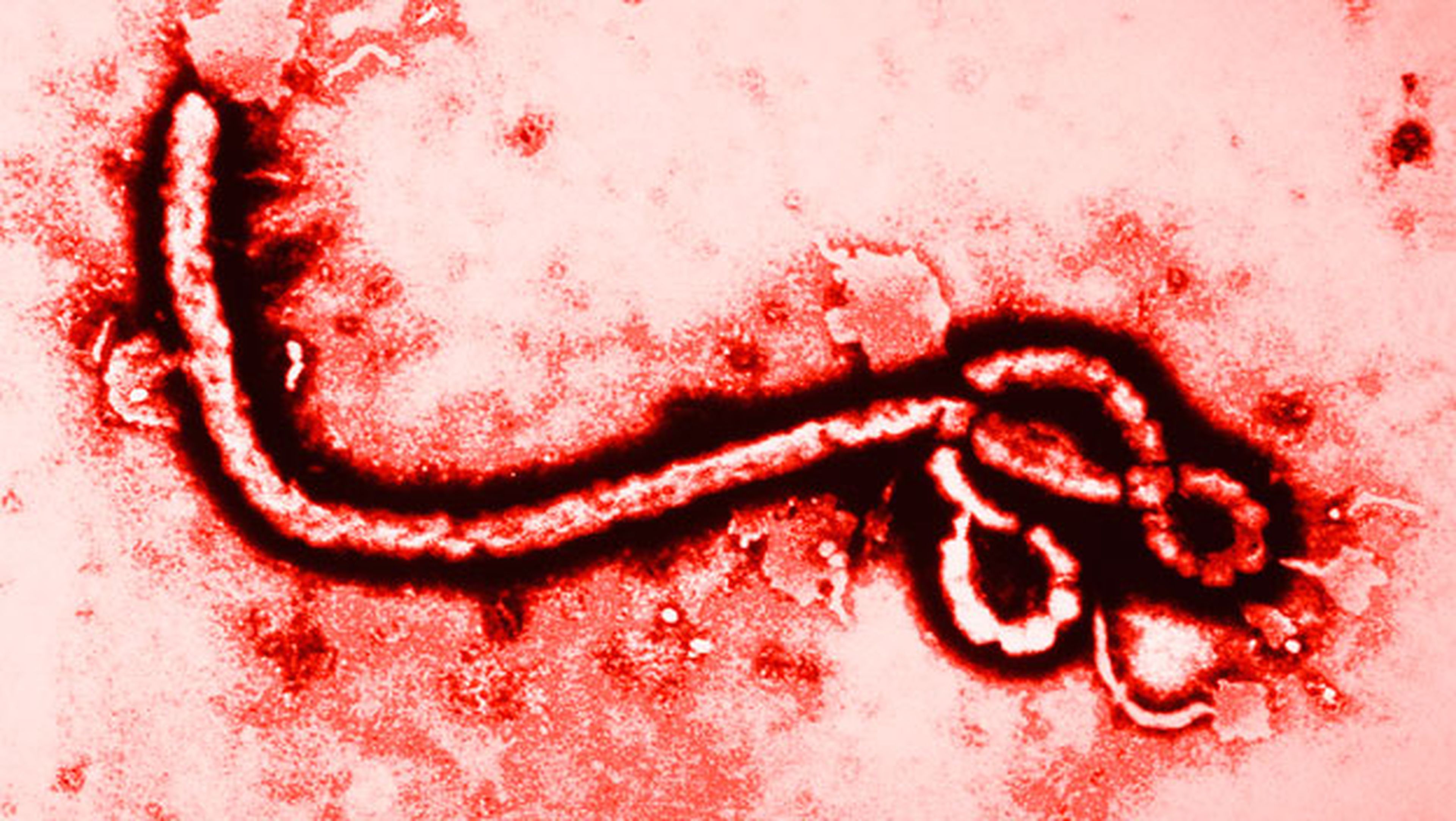 virus del ebola