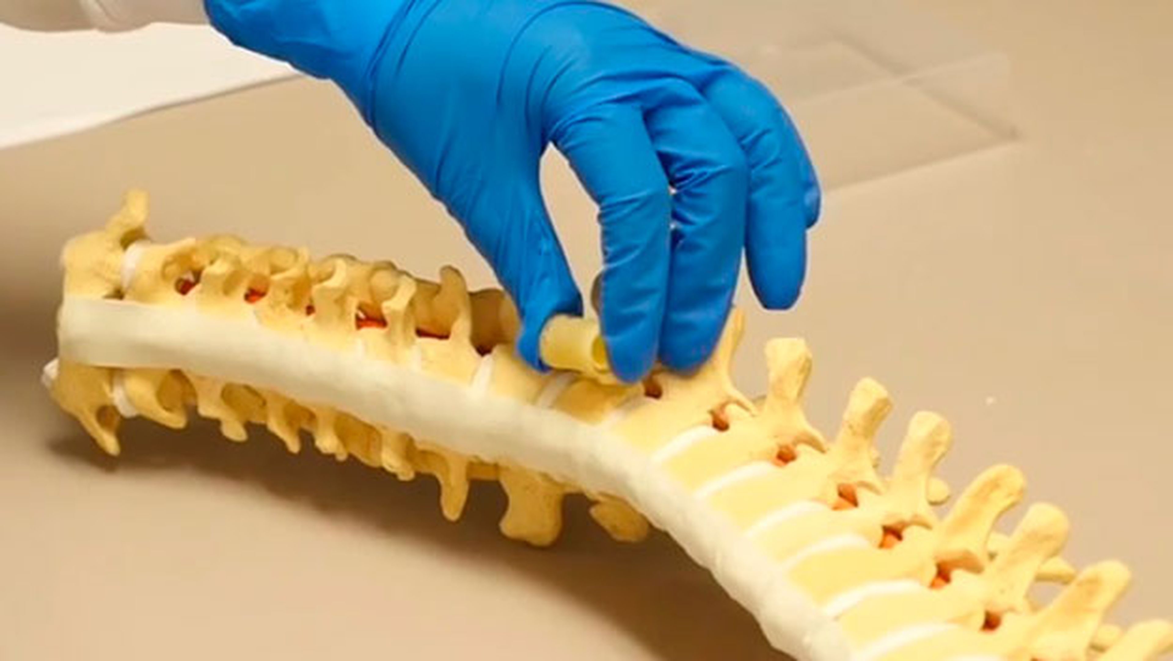 implante espina dorsal