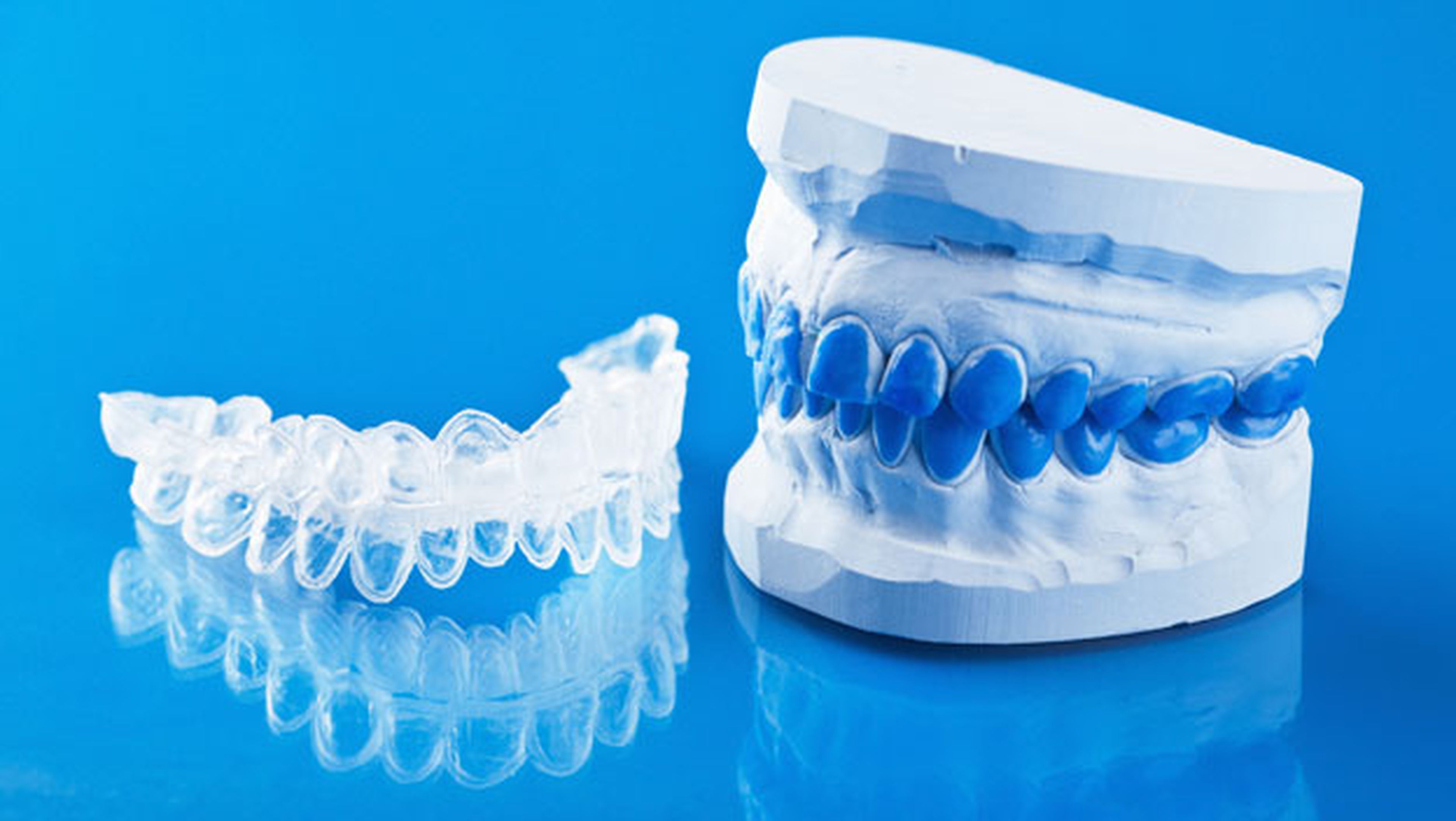 bracets ortodoncia impresora 3d