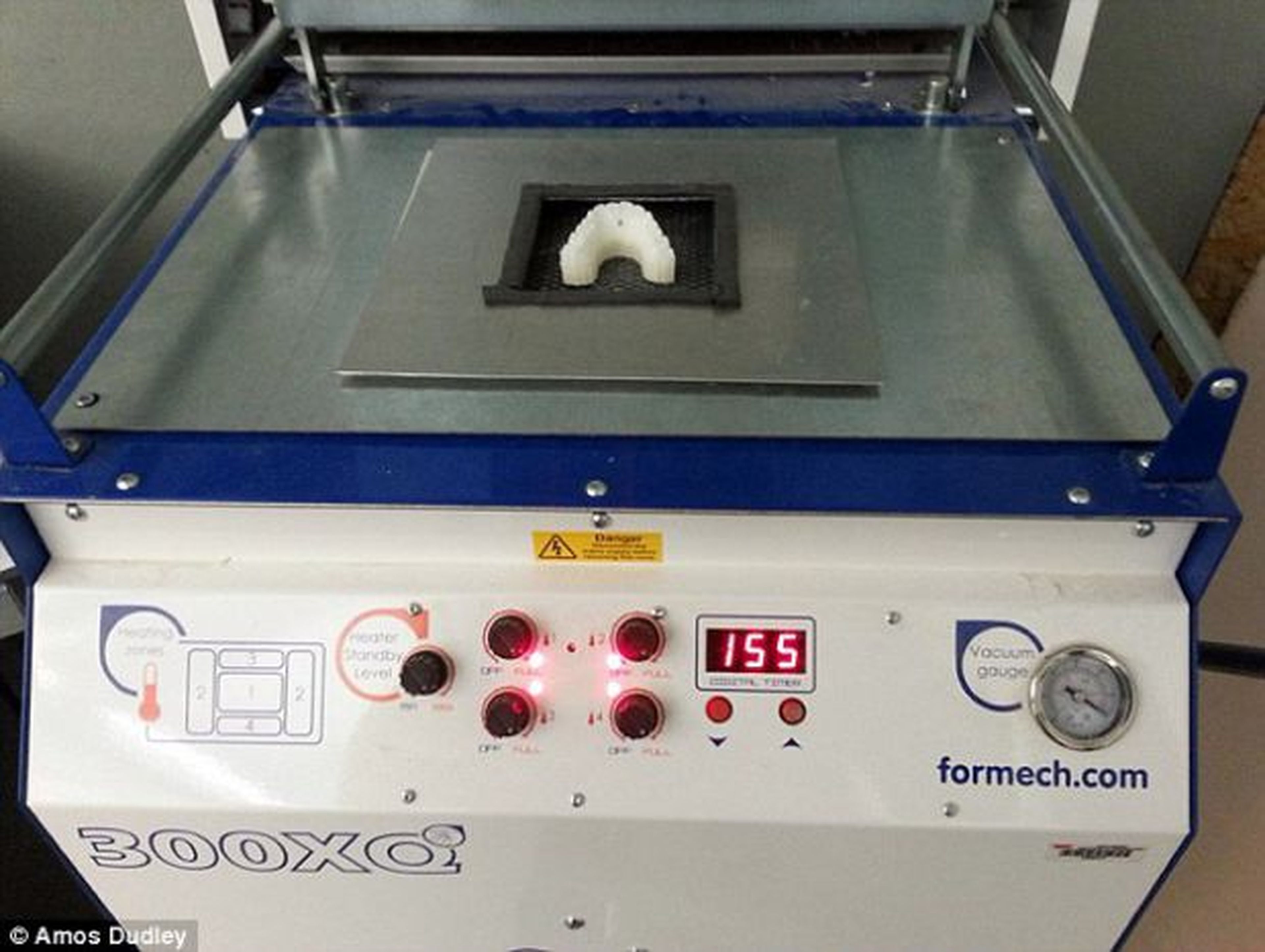 Corrector dental fabricado con una impresora 3D