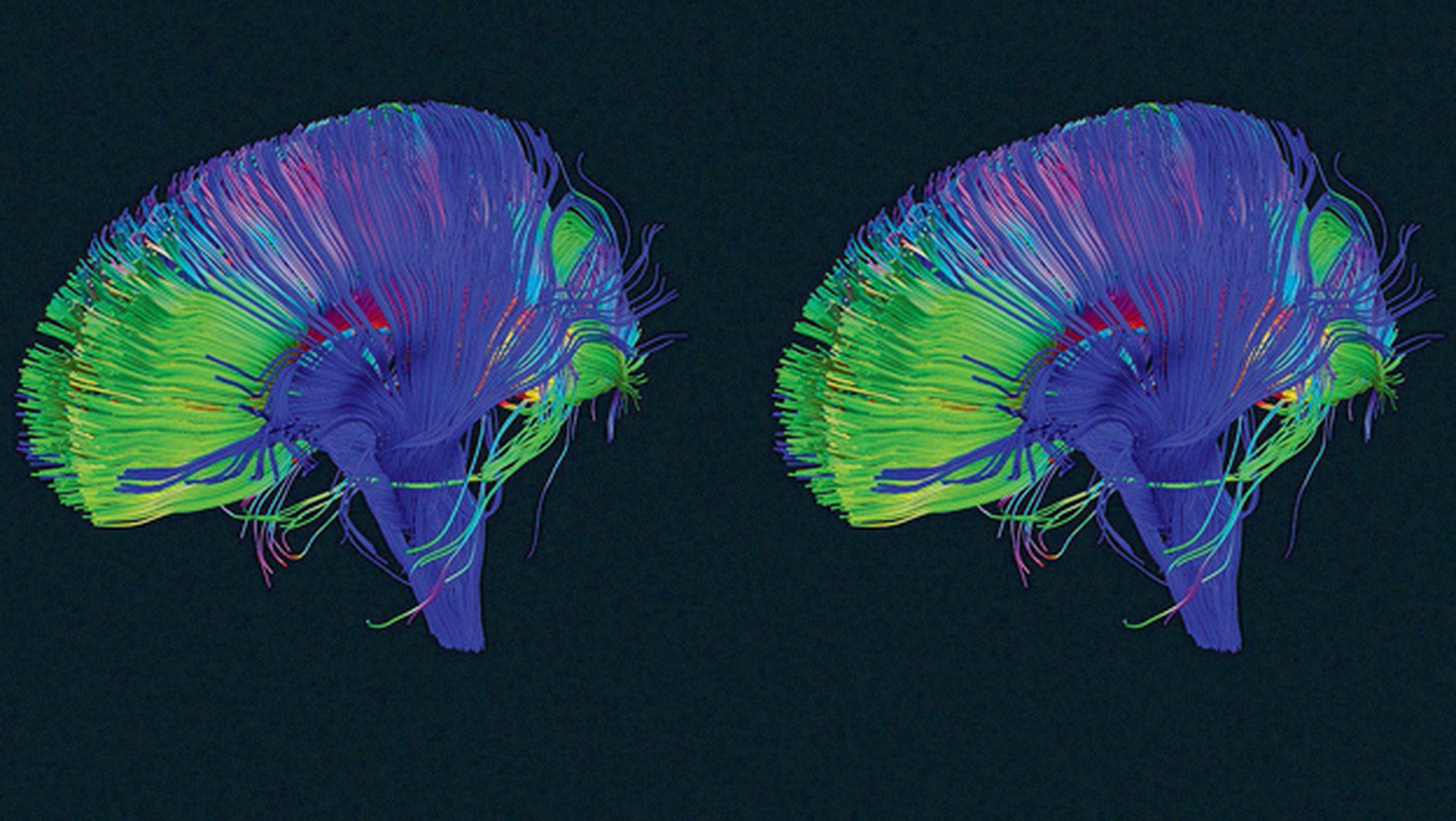 Cómo funcionan las conexiones sinápticas del cerebro