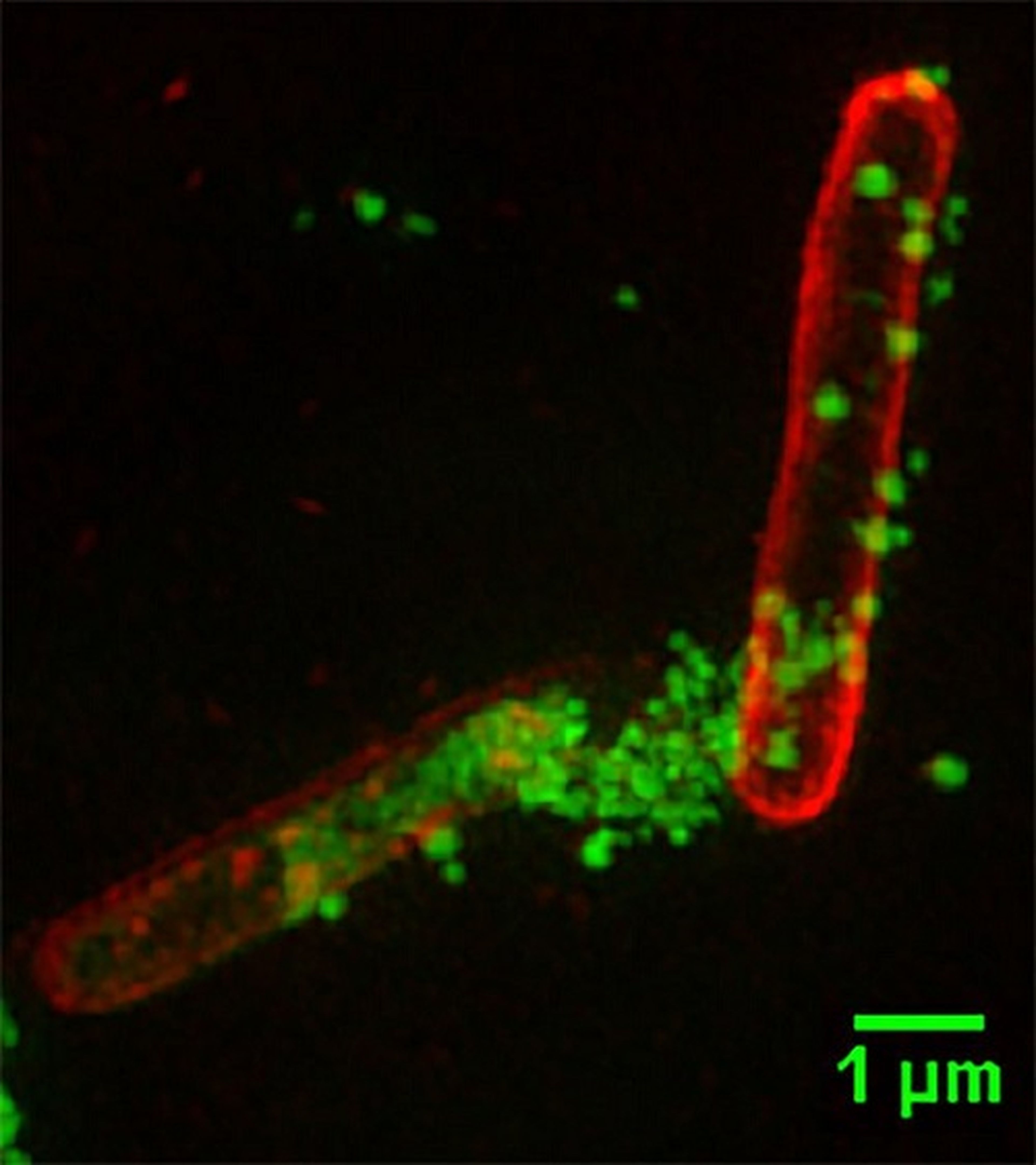 Polímero ataca cepa de superbacteria