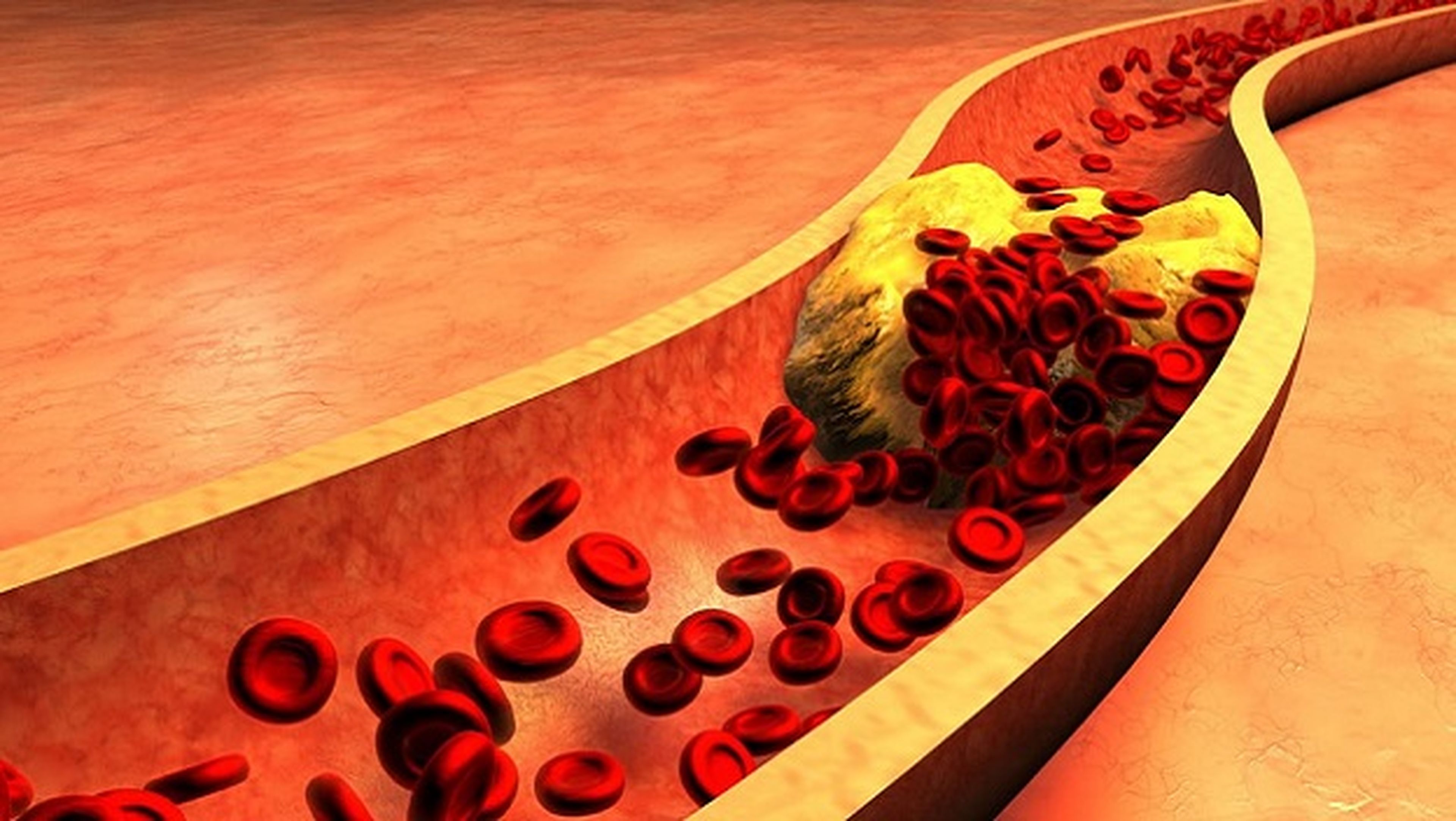 Microcámara transmite en vivo del interior de arterias