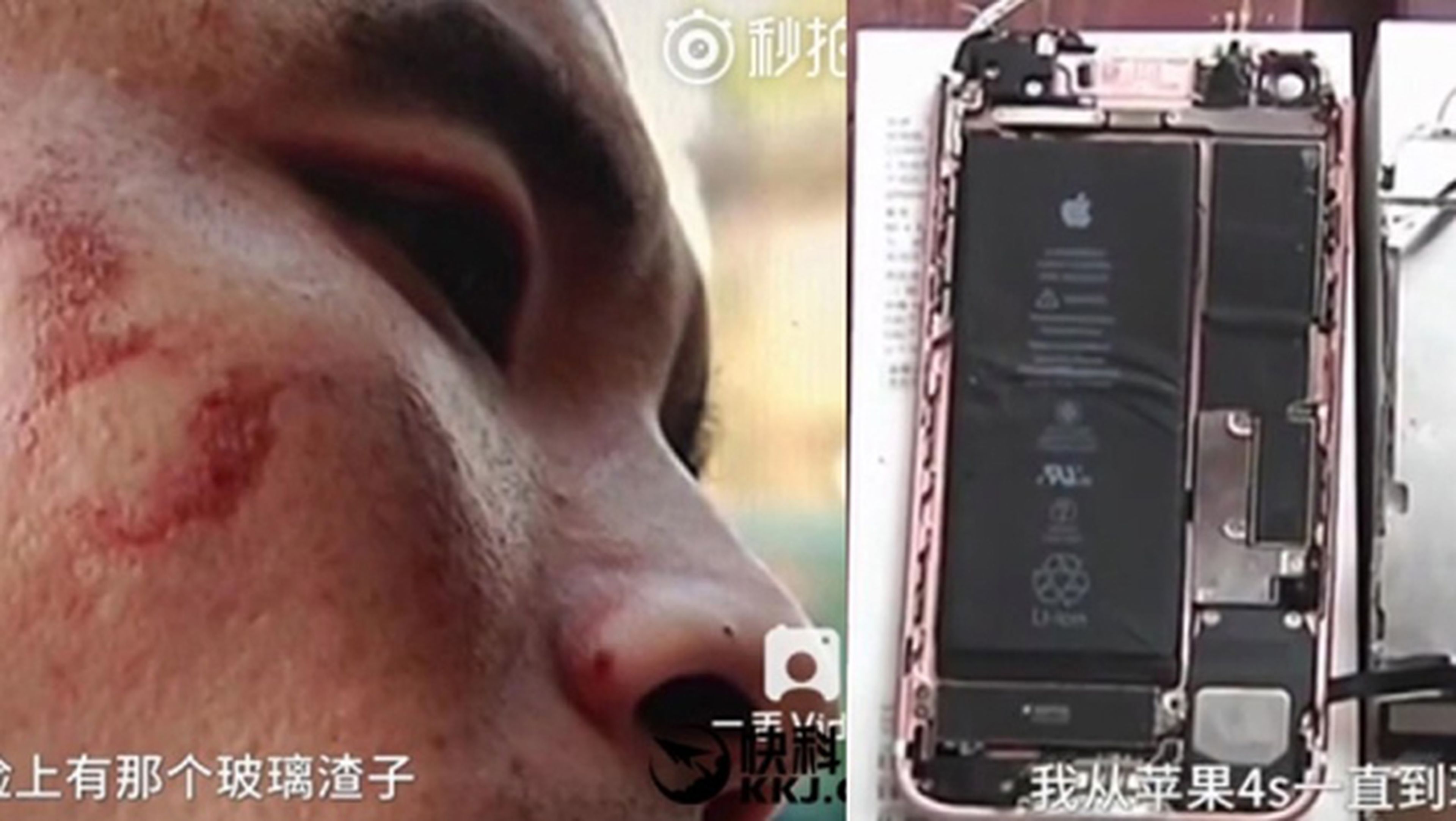 Un iPhone 7 le explota en la cara mientras grababa un vídeo