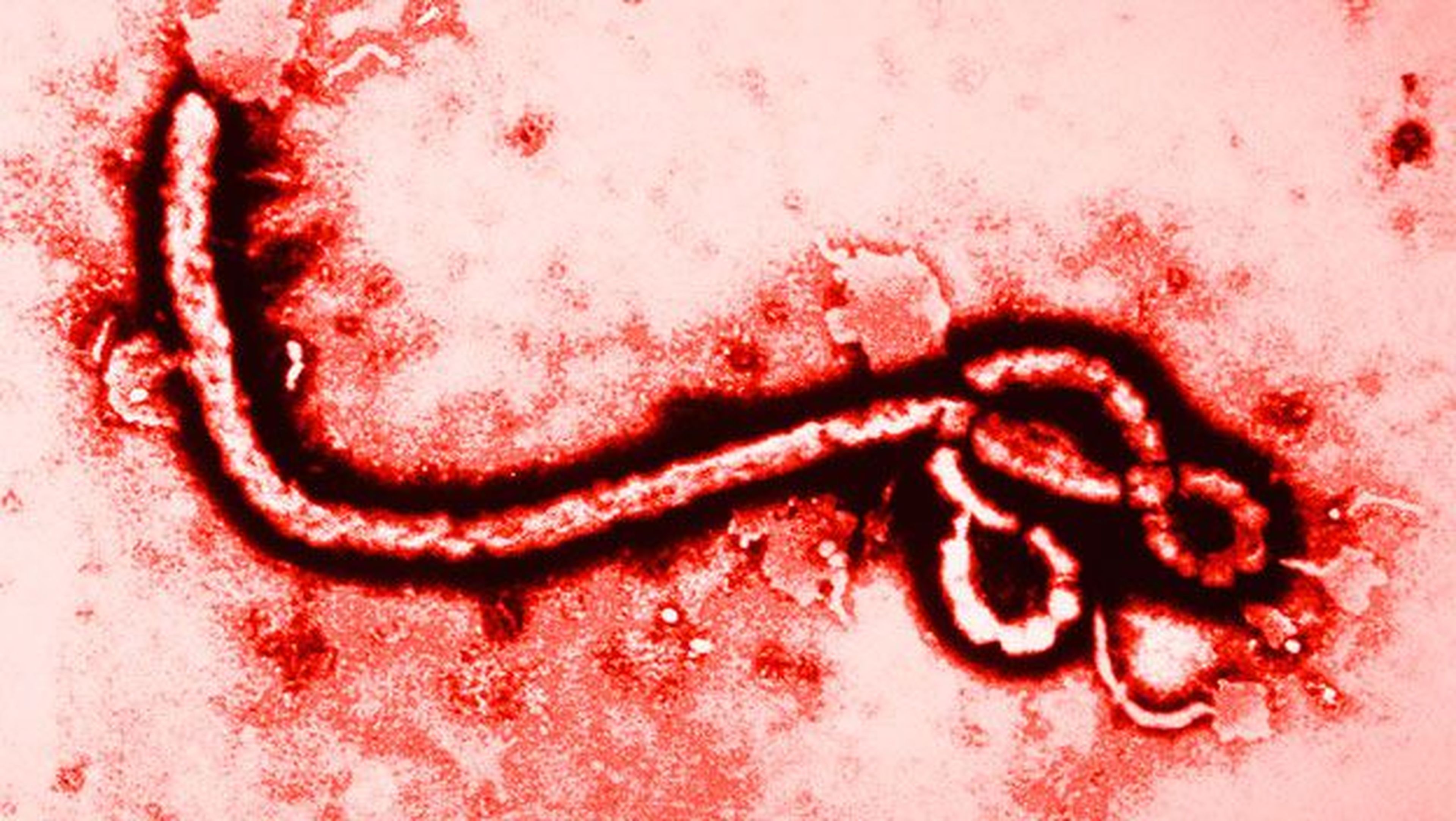 La vacuna que frena el ébola