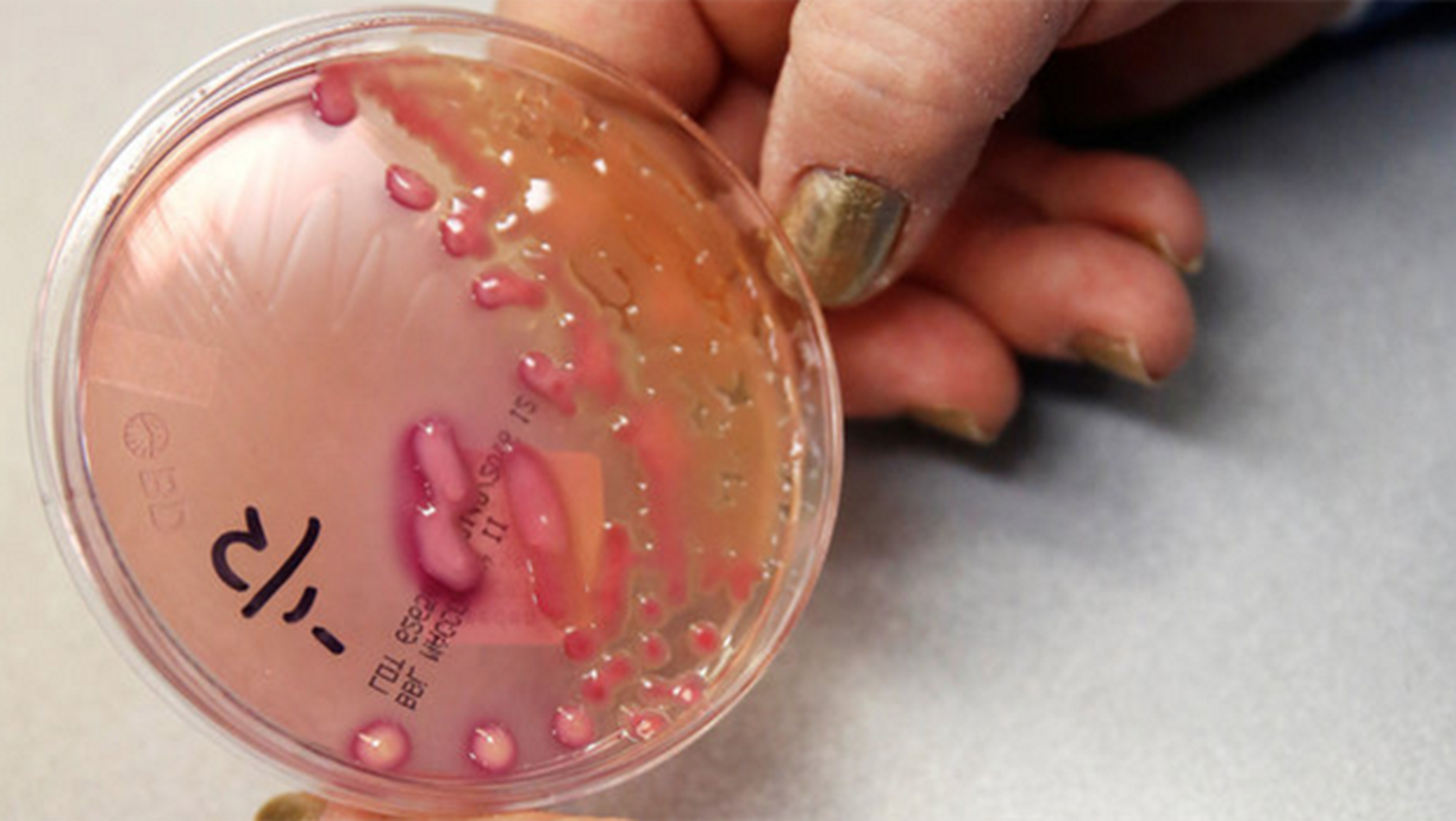Descubren la primera bacteria resistente a los antibióticos