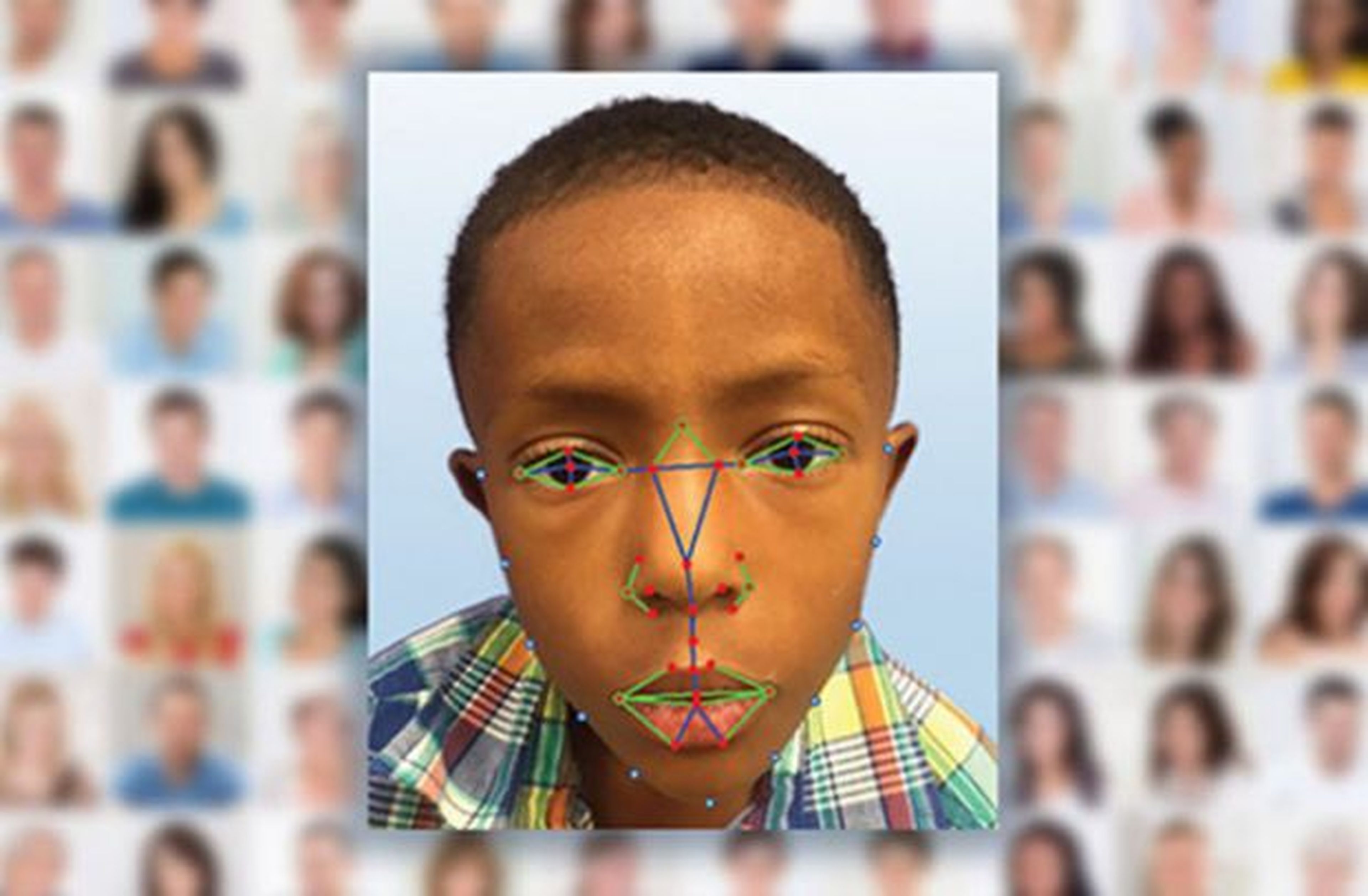 El reconocimiento facial ayudará a detectar enfermedades genéticas