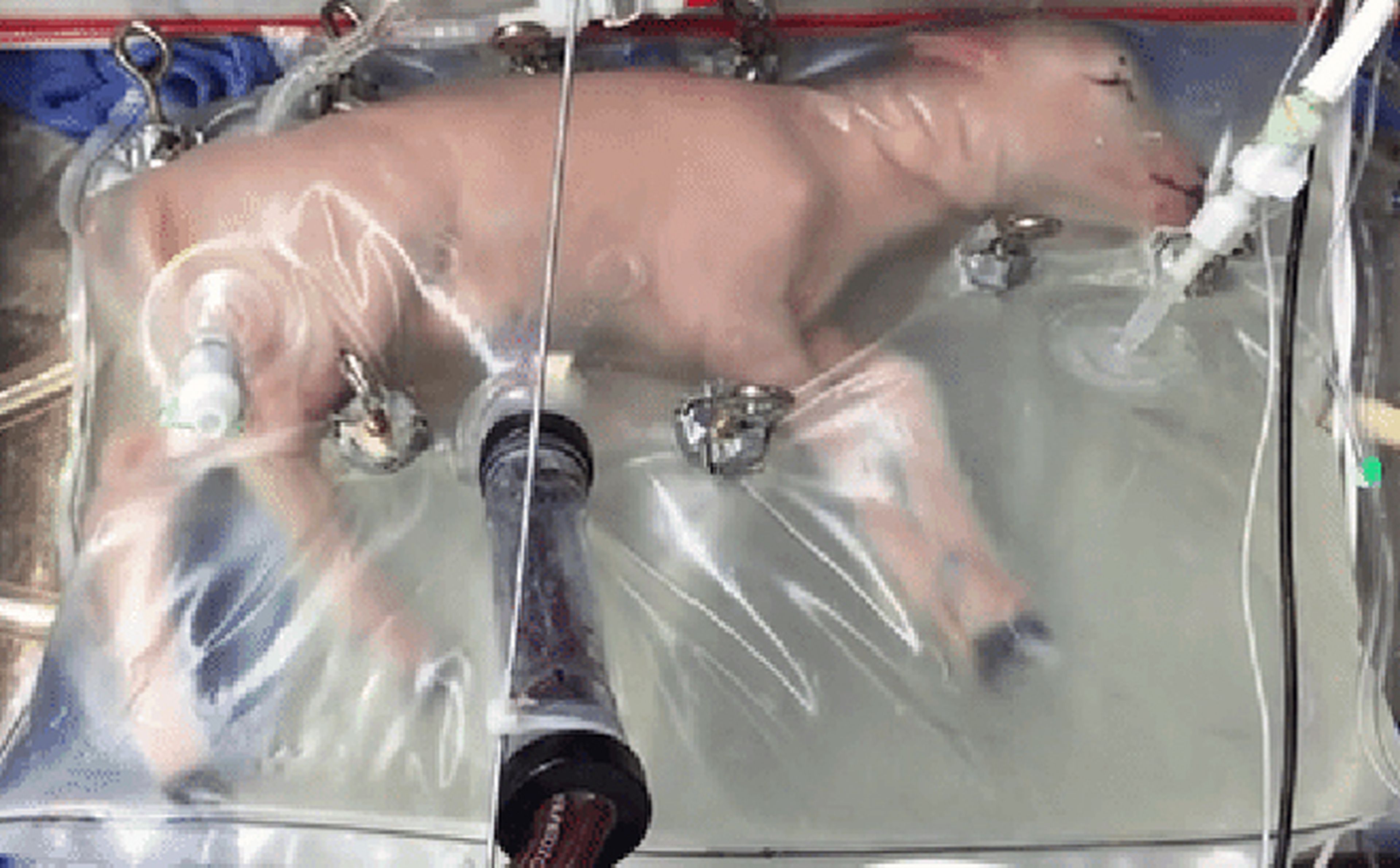 Consiguen gestar con éxito ovejas en un útero artificial