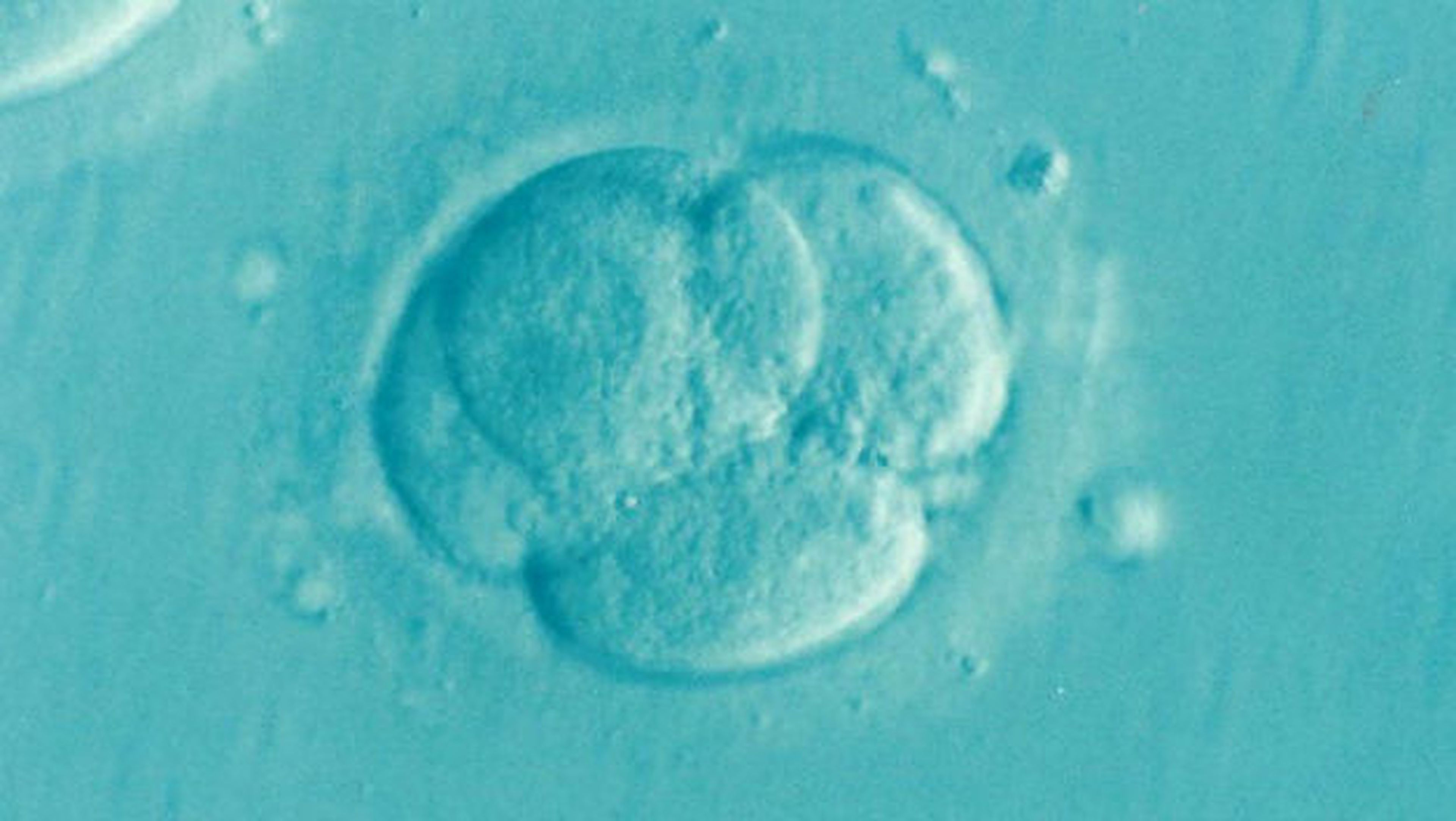 Un embrión humano ha sido modificado por primera vez con éxito por un grupo de investigadores de Estados Unidos