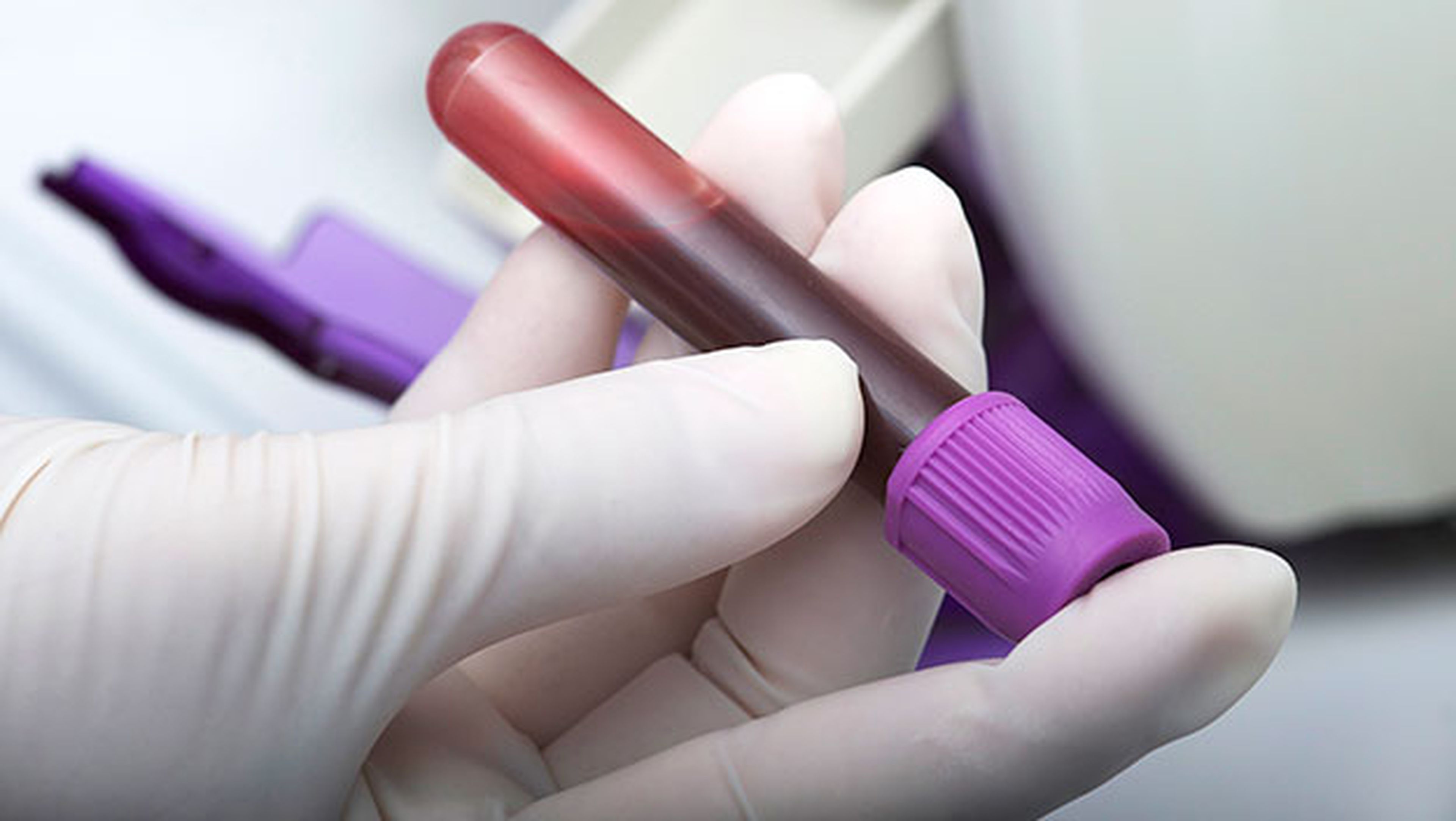 análisis sangre cancer