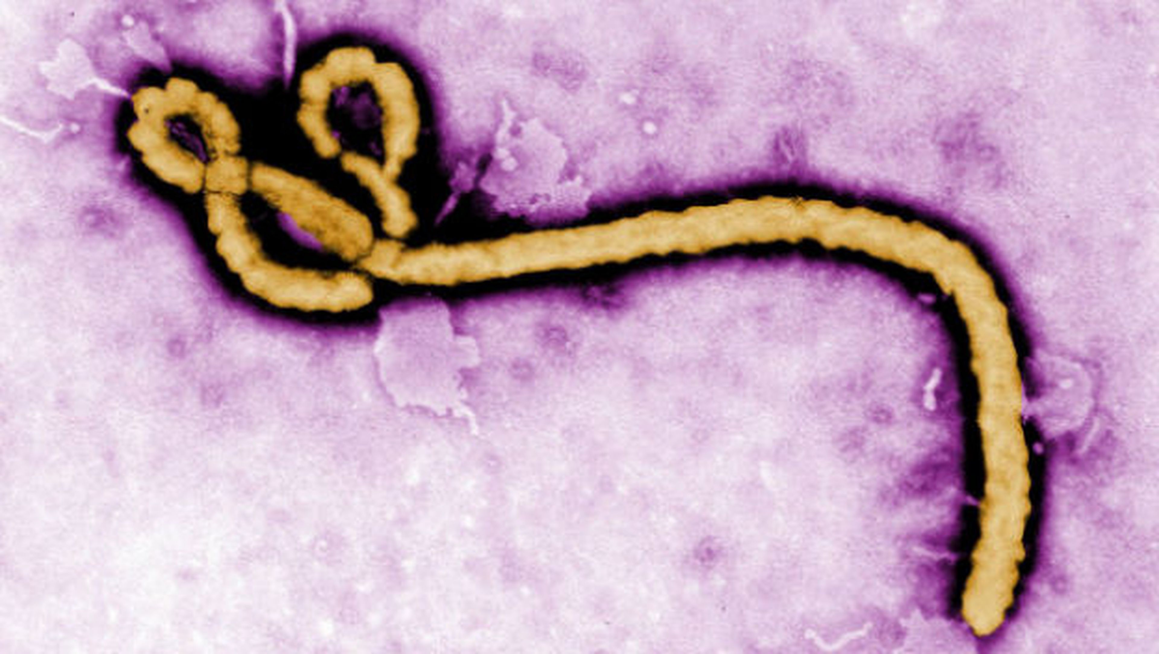 Ya hay una nueva vacuna efectiva contra el virus del ébola.