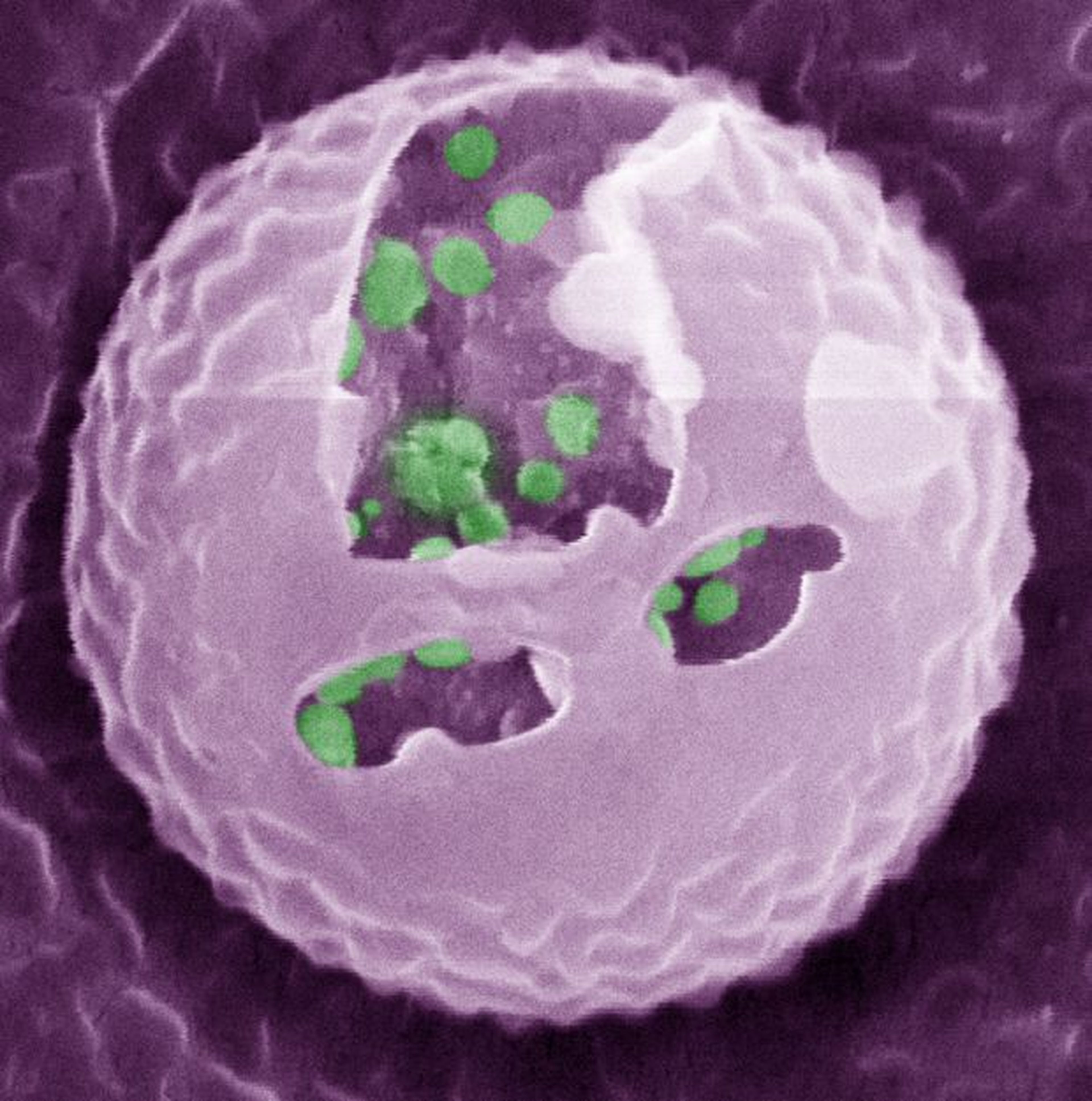 Imagen de fluorescencia de las células beta artificiales (Gu Lab, UNC-NC State)