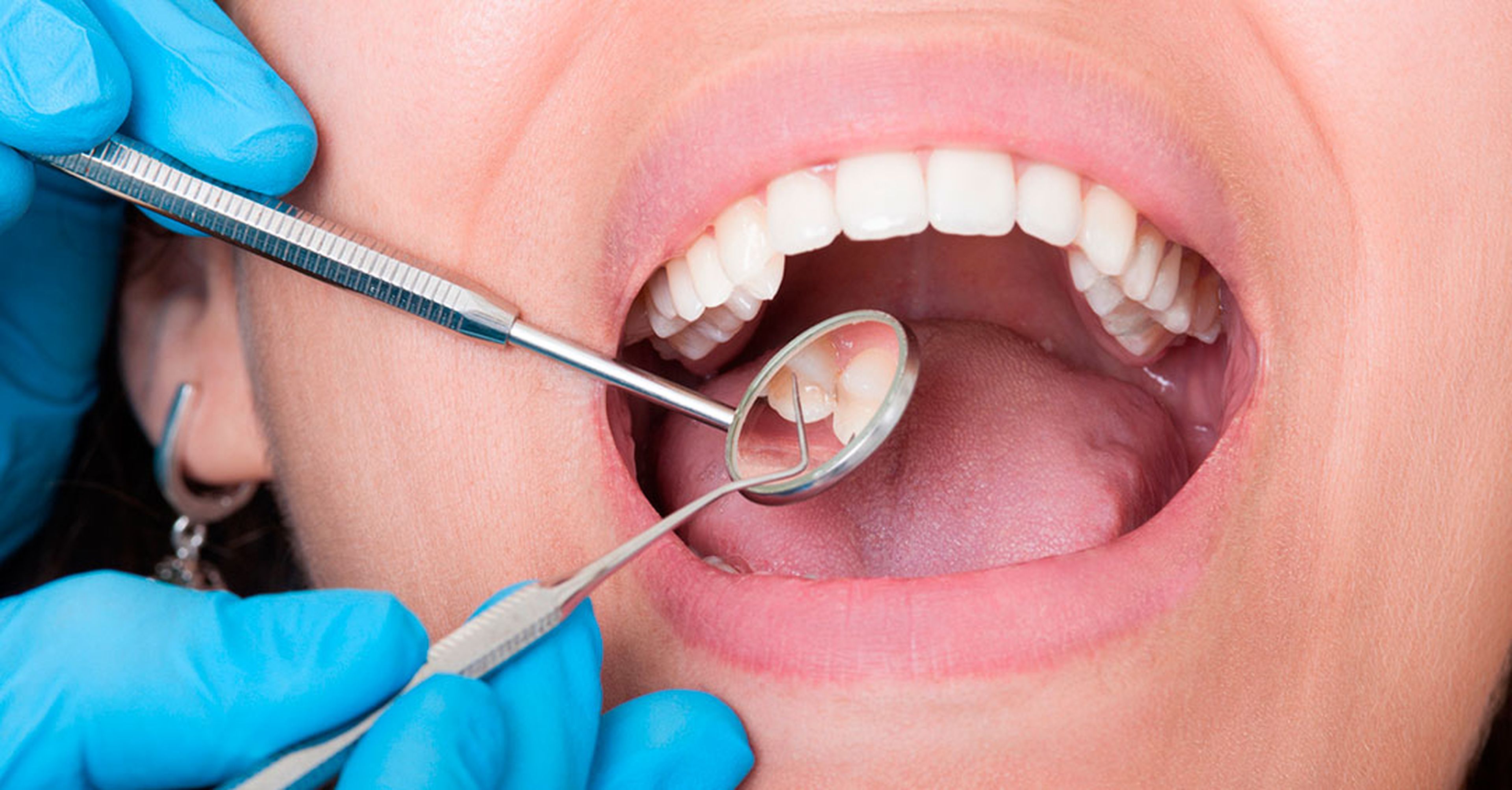 dientes dentista