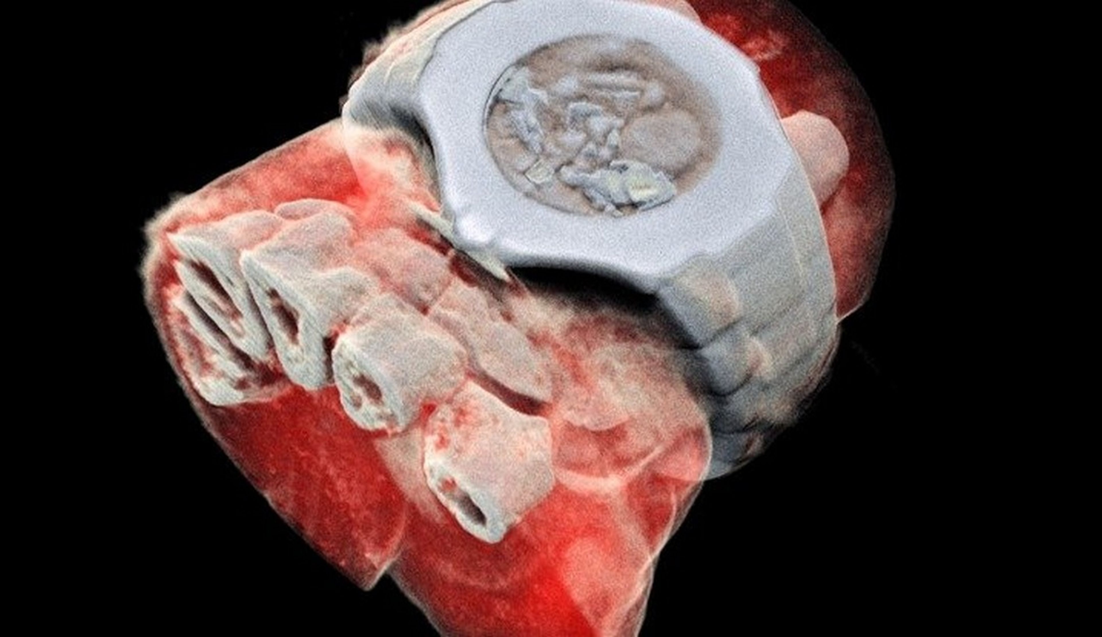 Las primeras radiografías en 3D y en color son espectaculares