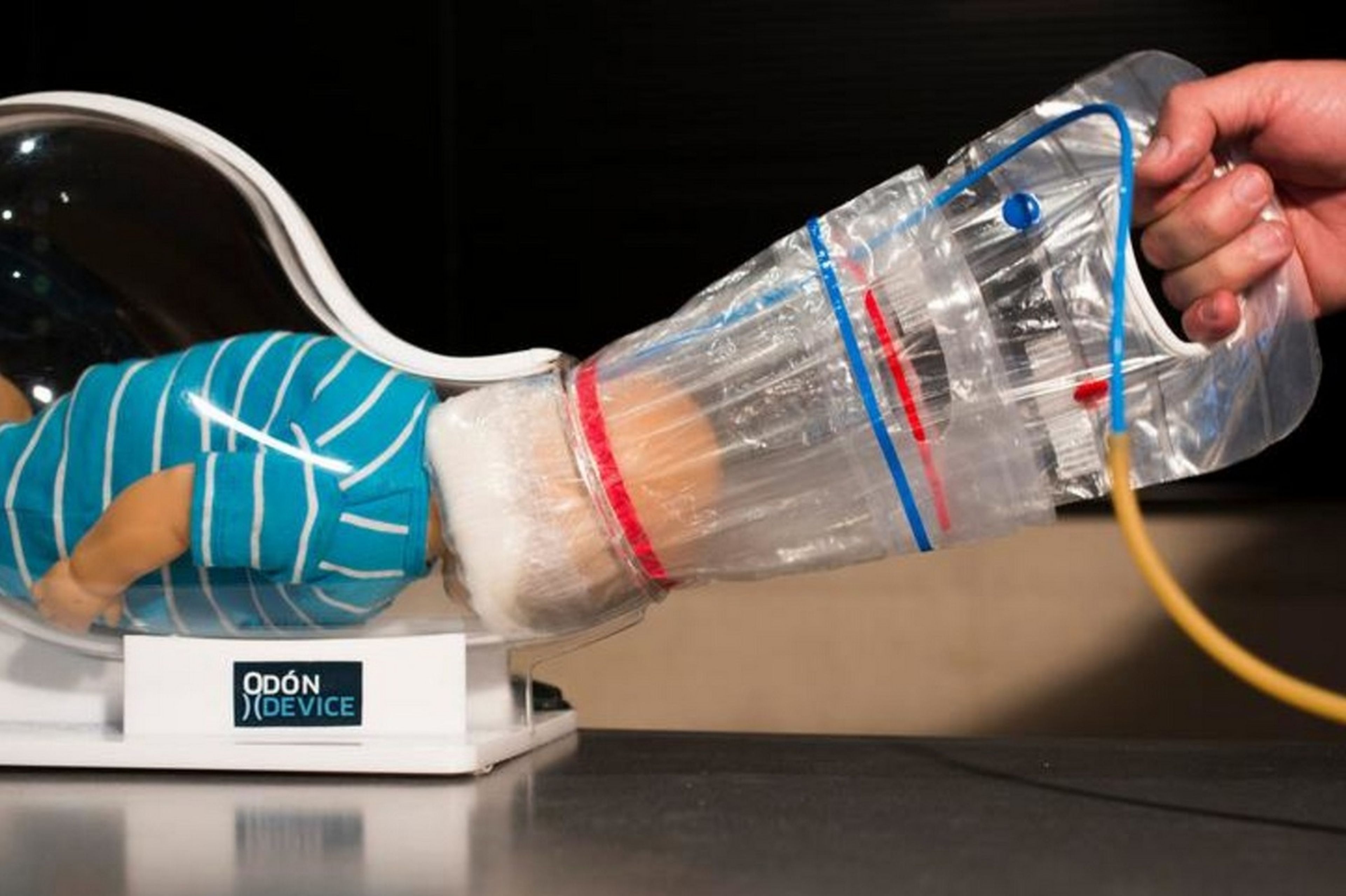 Odon Device, el facilitador de partos que podría salvar miles de vidas