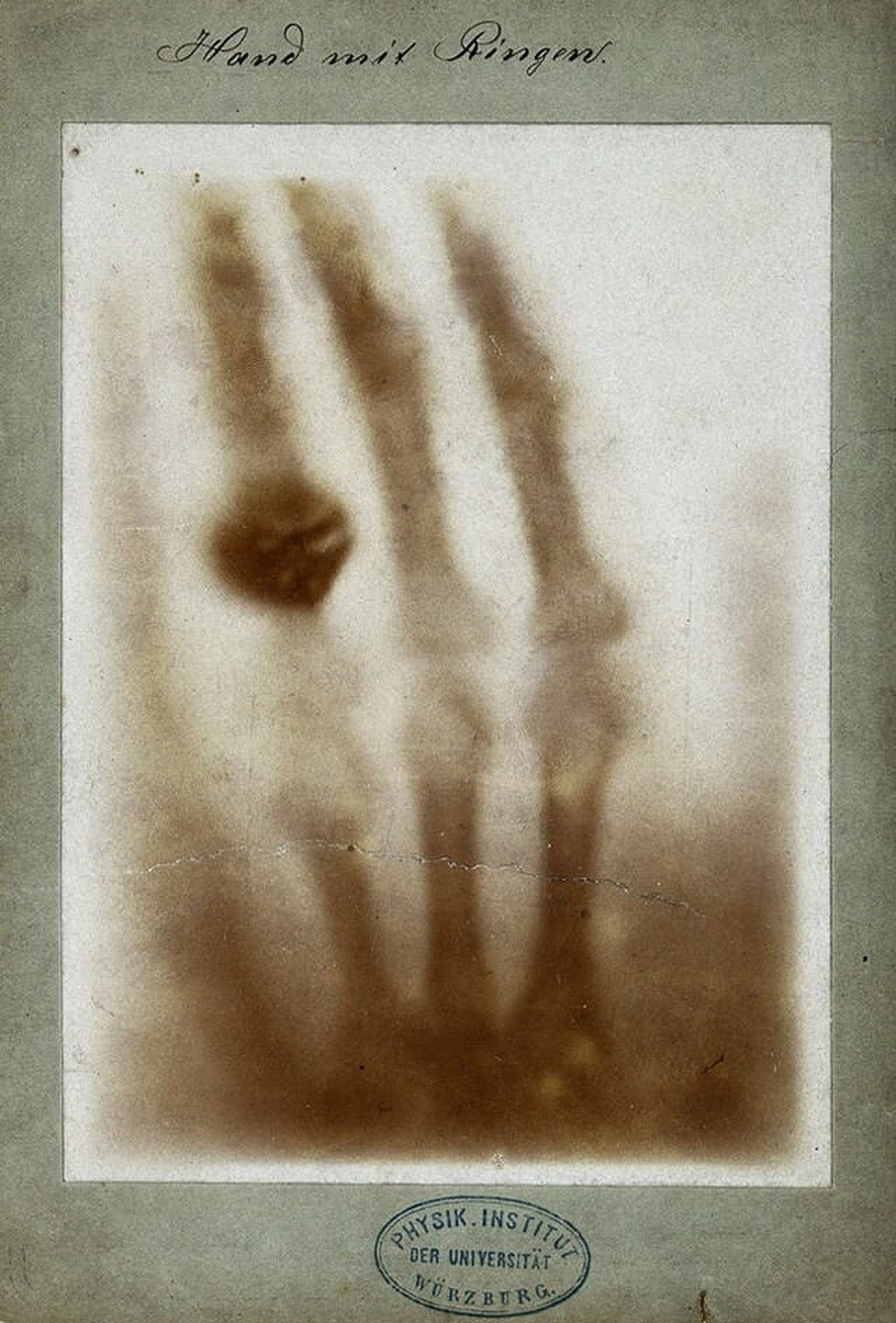 primera radiografia