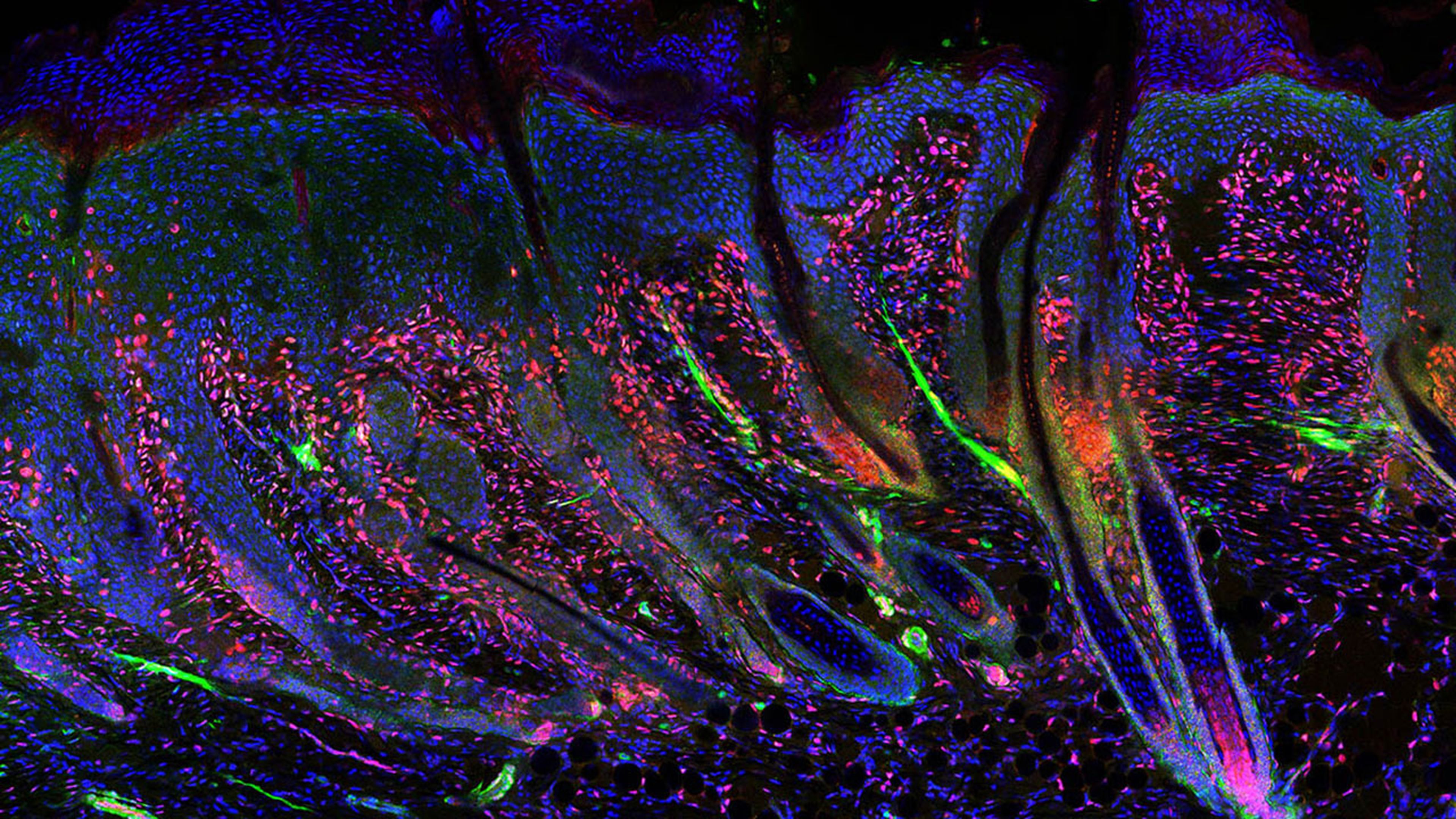 Una imagen de una herida cutánea en regeneración con folículos pilosos