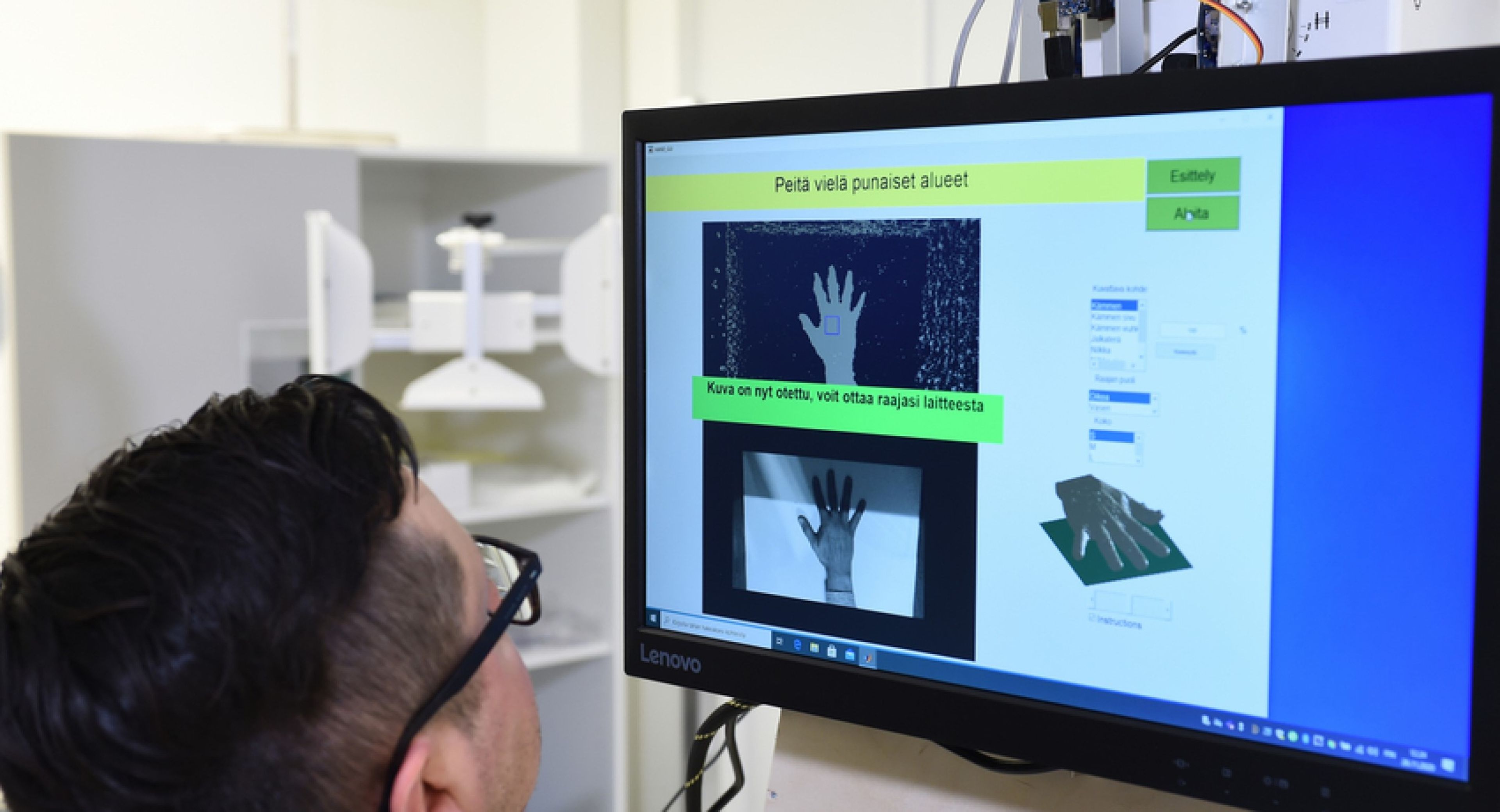 Estos investigadores proponen una máquina de rayos X "portátil" para autodiagnósticos