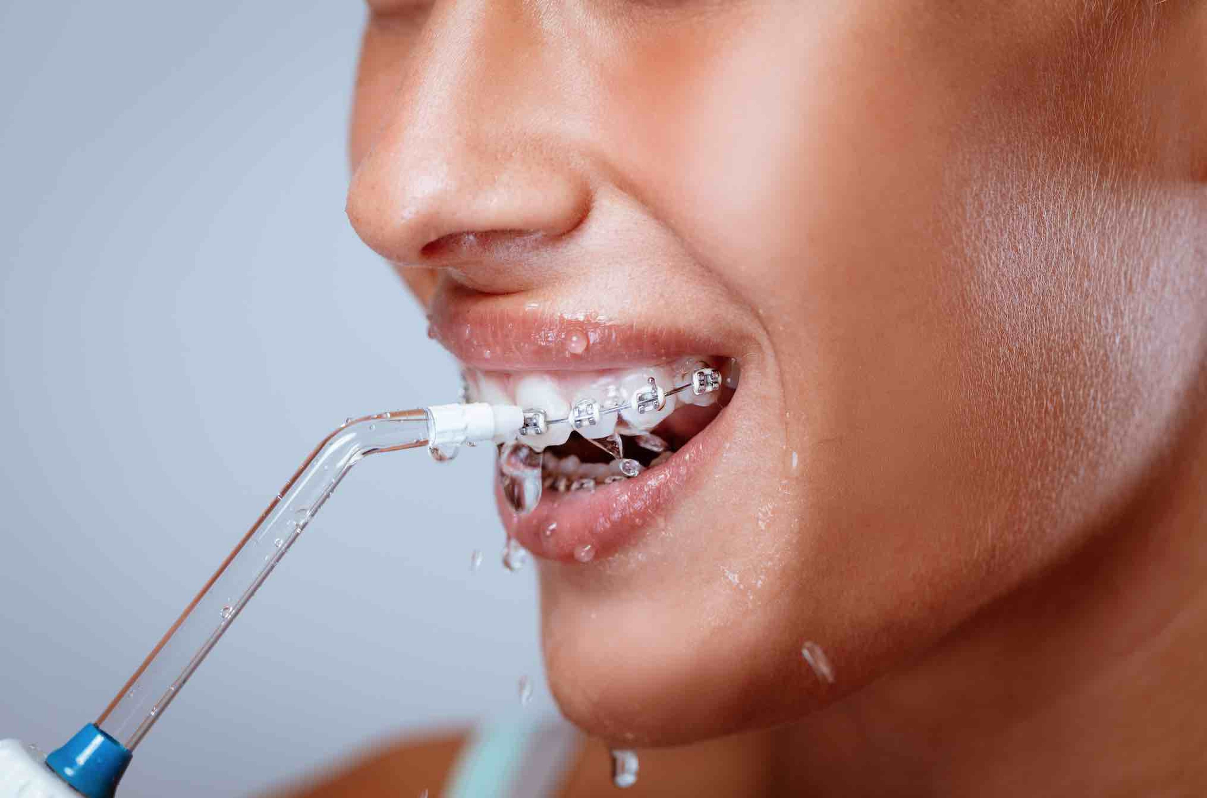 Producto Percibir Cálculo Qué es y para qué sirve un irrigador bucal: el gadget de moda para mantener  la salud de tus dientes | Computer Hoy