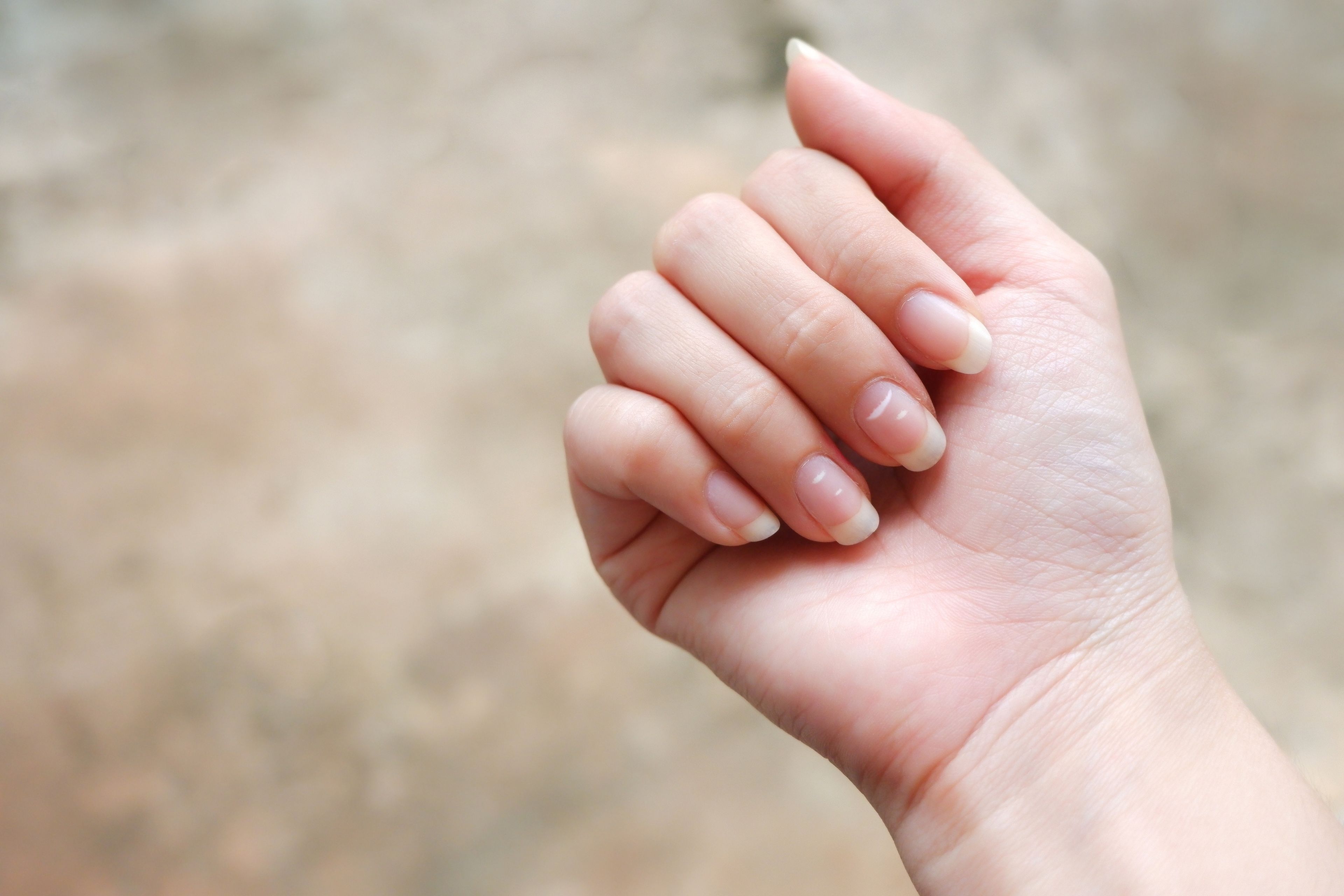 ¿Tienes manchas blancas en las uñas? Cinco causas que las provocan, y cómo evitarlo