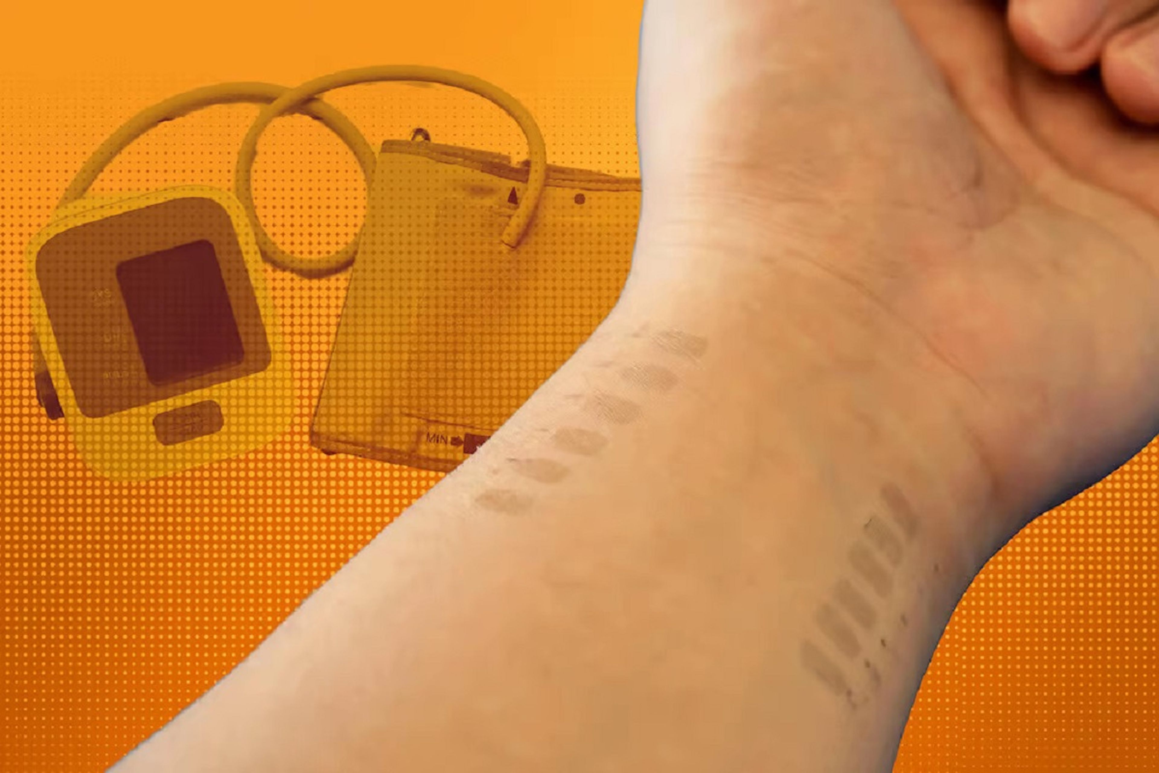 Científicos desarrollan un nuevo "tatuaje" electrónico que puede controlar la presión arterial