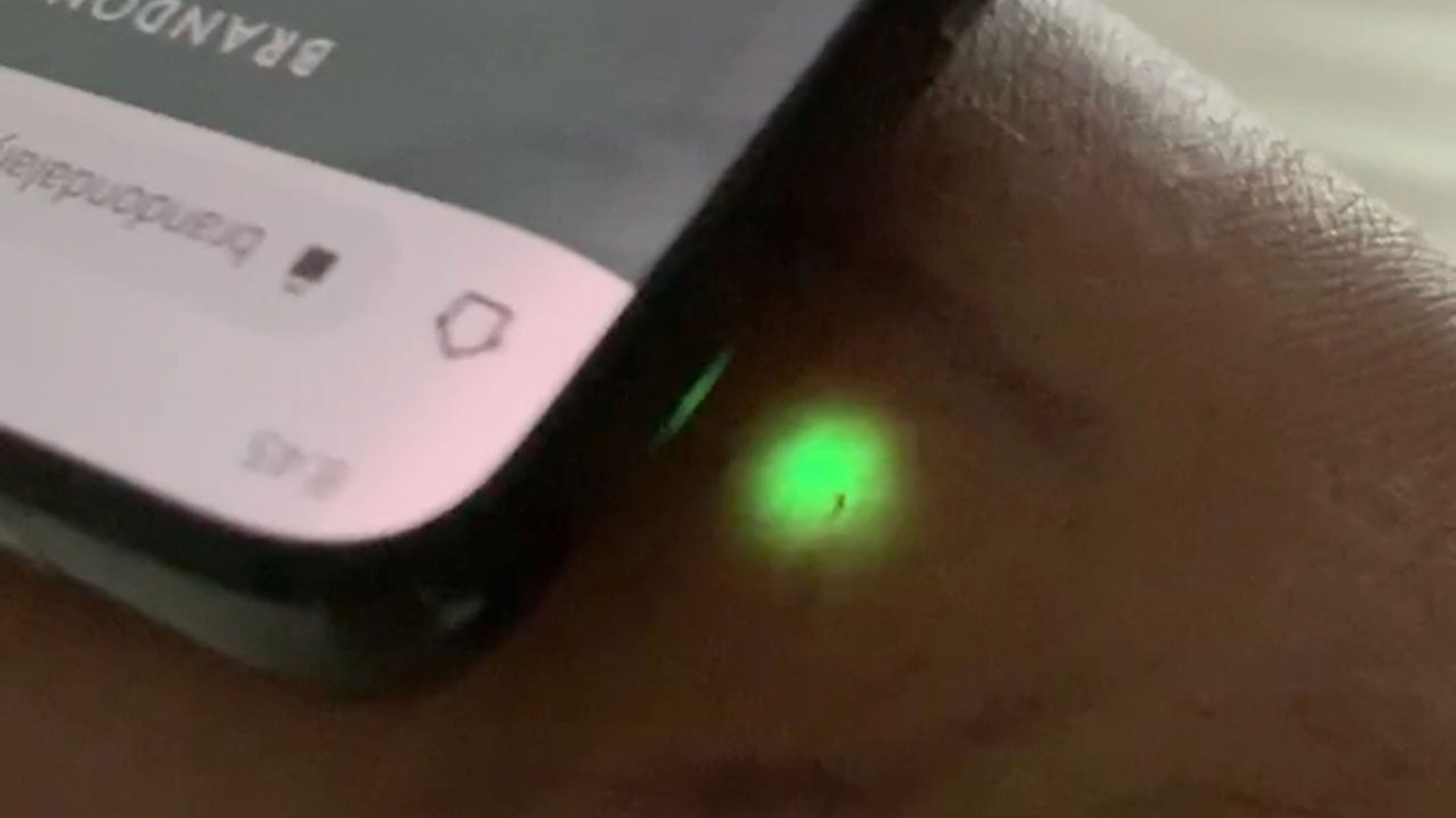 Este propietario de un Tesla se implanta un chip en su mano para desbloquear su coche y no depender del móvil