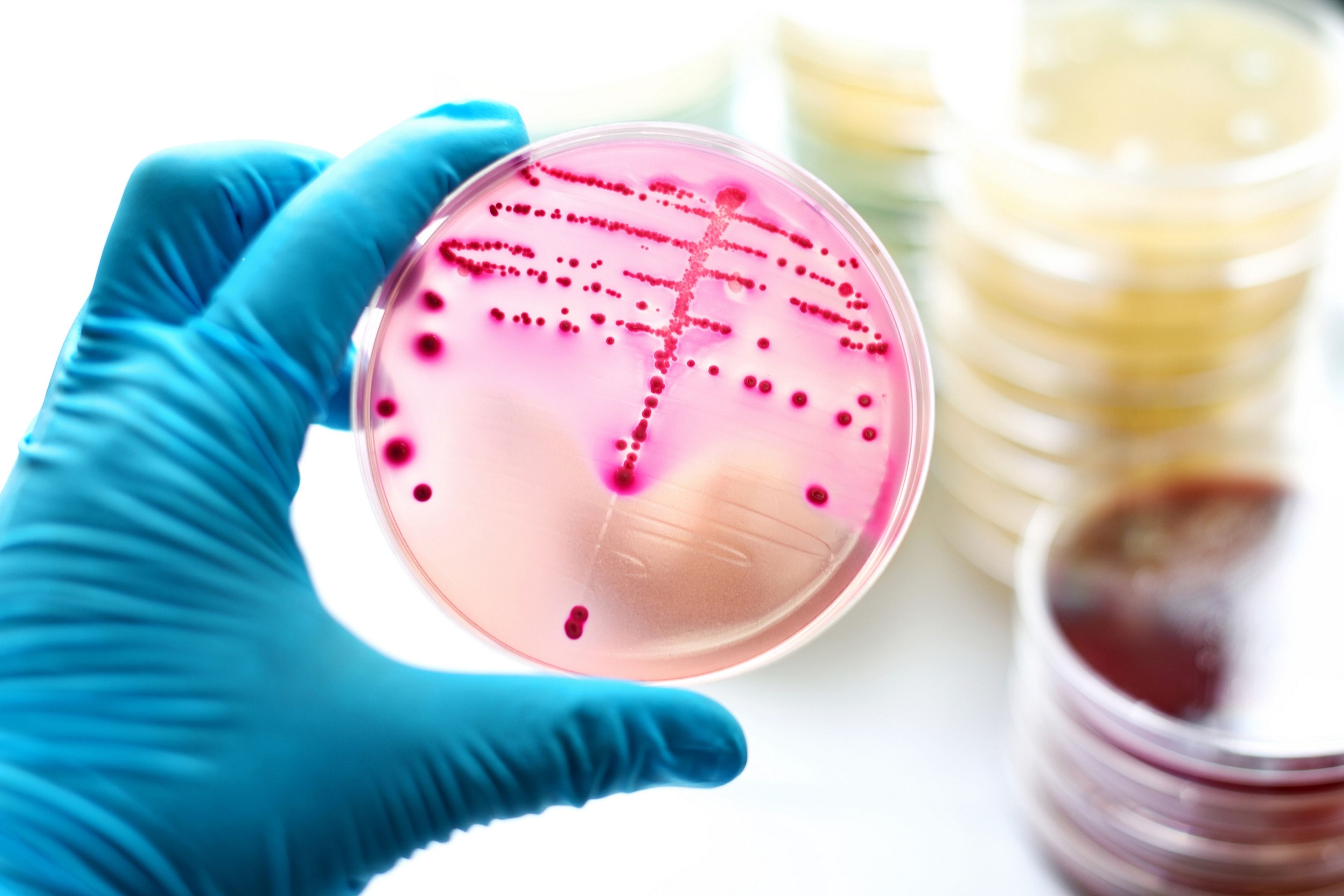 Descubren un nuevo truco de las bacterias para evitar los antibióticos, y da bastante miedo