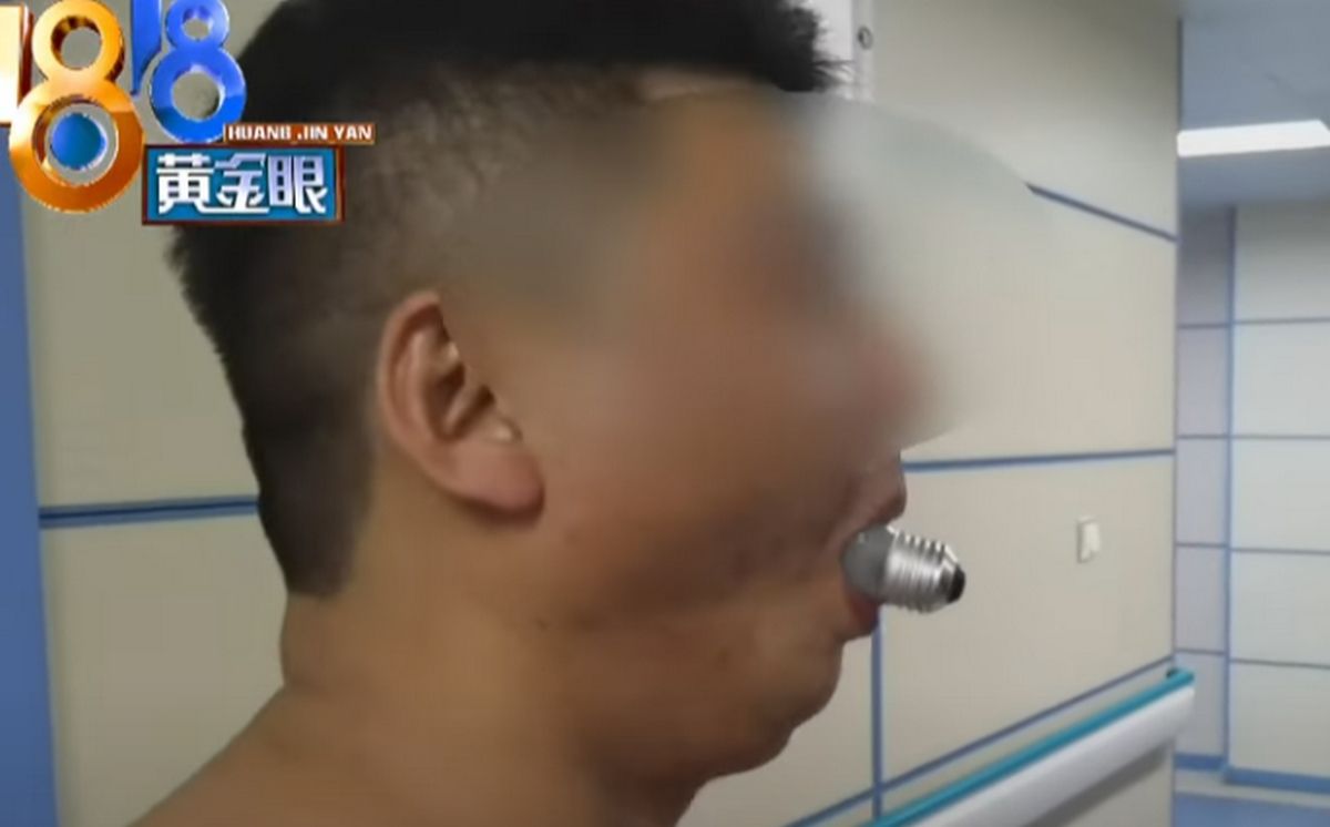 Beware of the absurd viral challenge of the light bulb in the mouth it