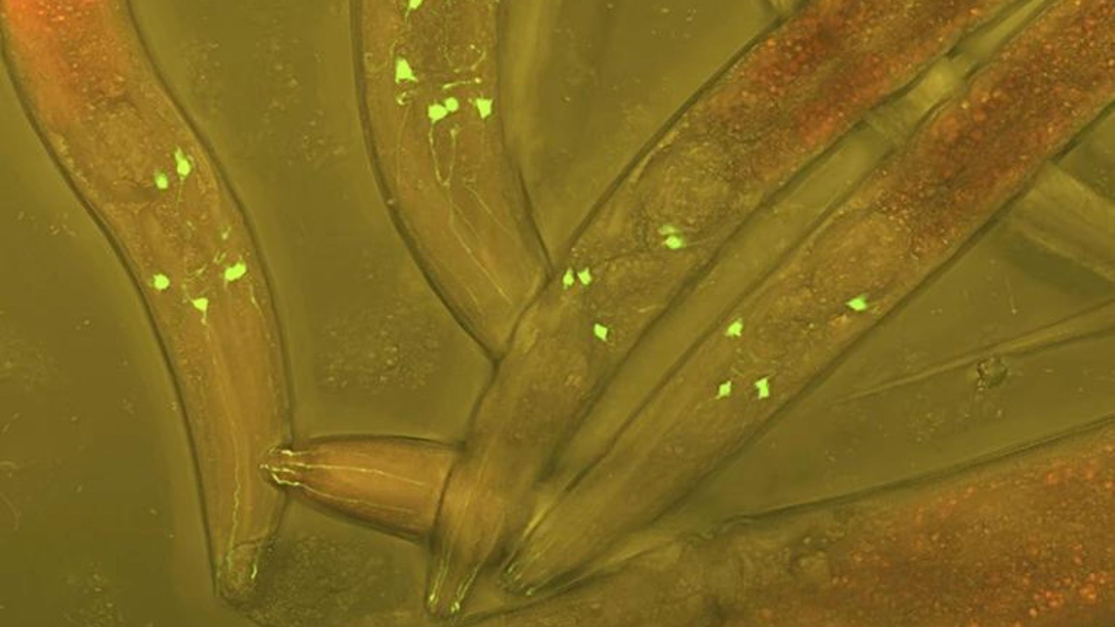 Gusano Caenorhabditis elegans. Crédito: Nature/ Heiti Paves/Biblioteca de fotografías científicas