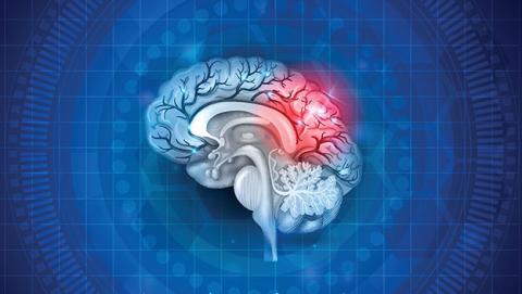 tumor cerebral tumor cerebral