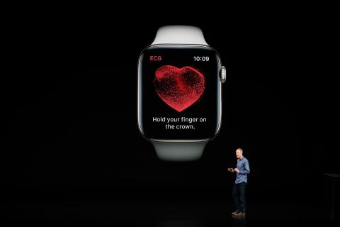Electrocardiograma del Apple Watch Electrocardiograma del Apple Watch